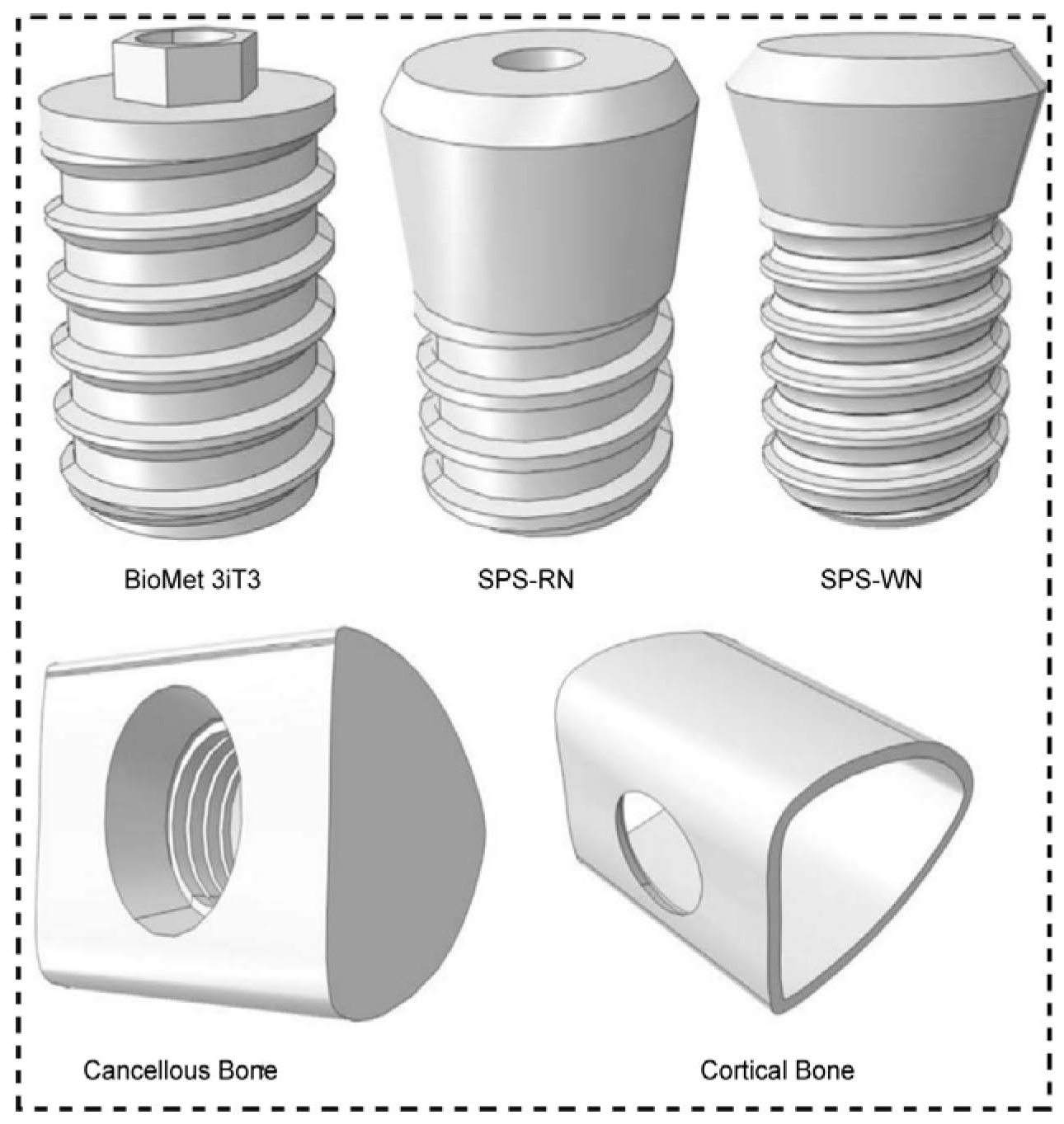 Nonlinear Finite Element Analysis of Bone–Implant Contact in Three ...