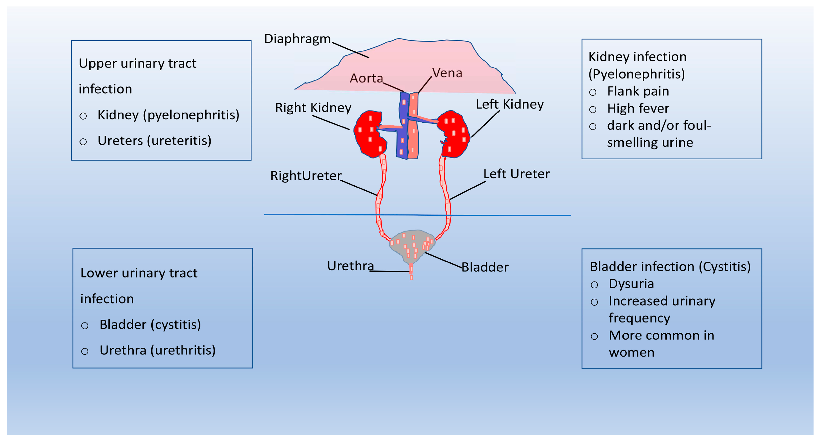 PDF) Acute urinary retention in pregnancy: A case presentation and