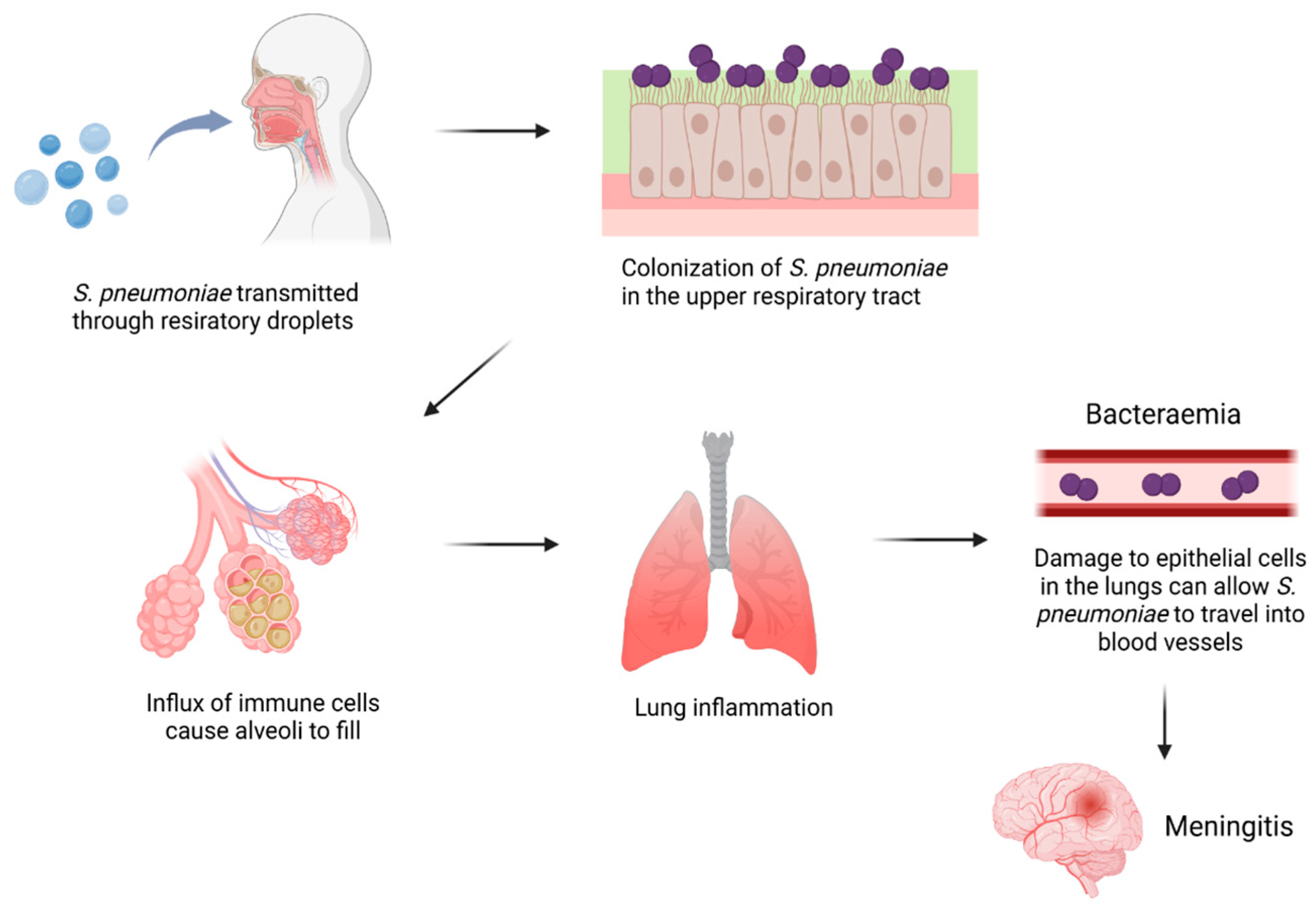 Influence of Aging and Immune Alterations on Susceptibility to ...