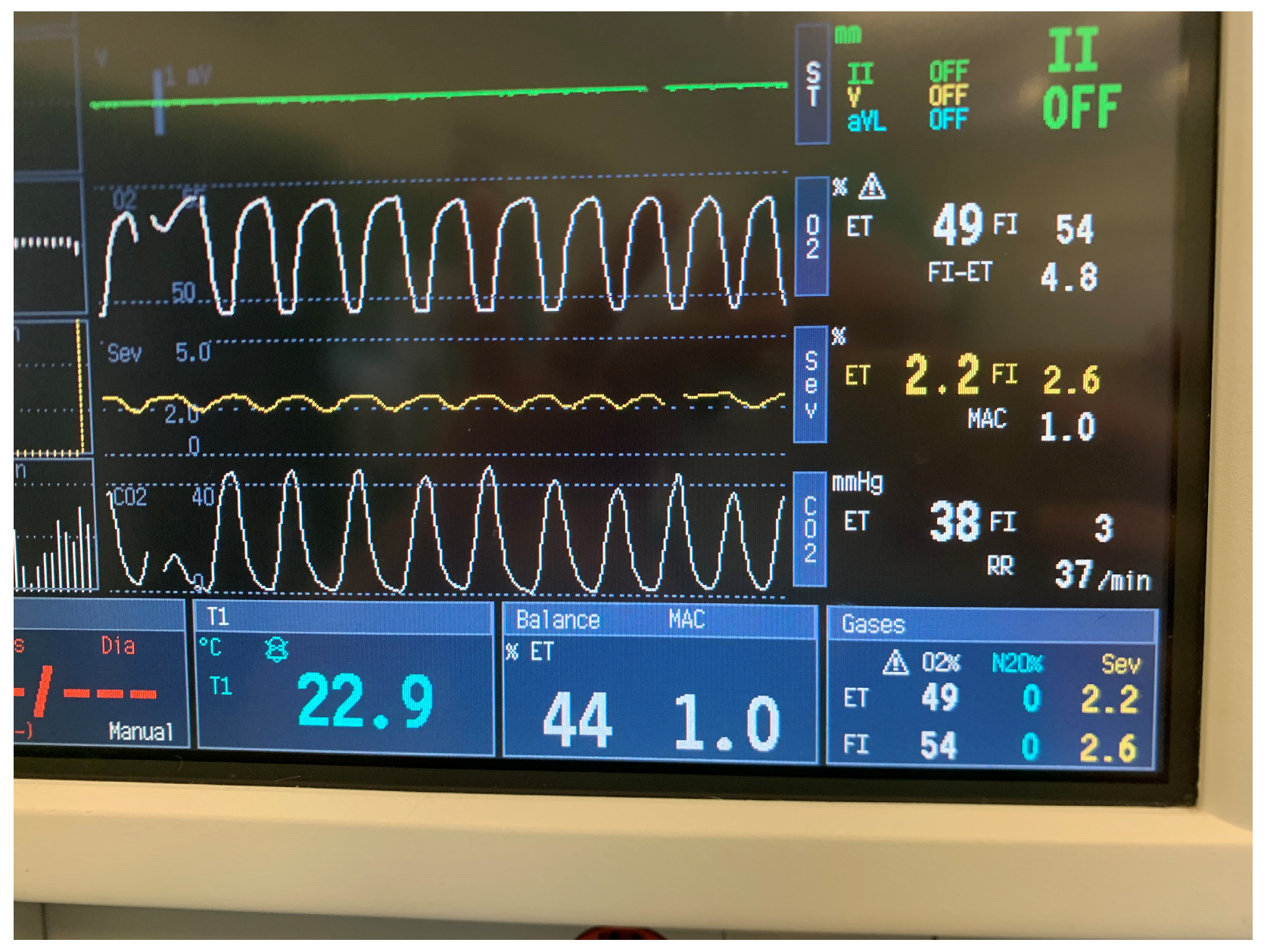 Perioperative Monitoring in Rabbits Under General Anaesthesia: A ...