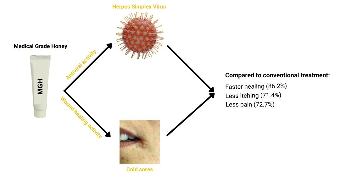 herpes simplex 1 treatment