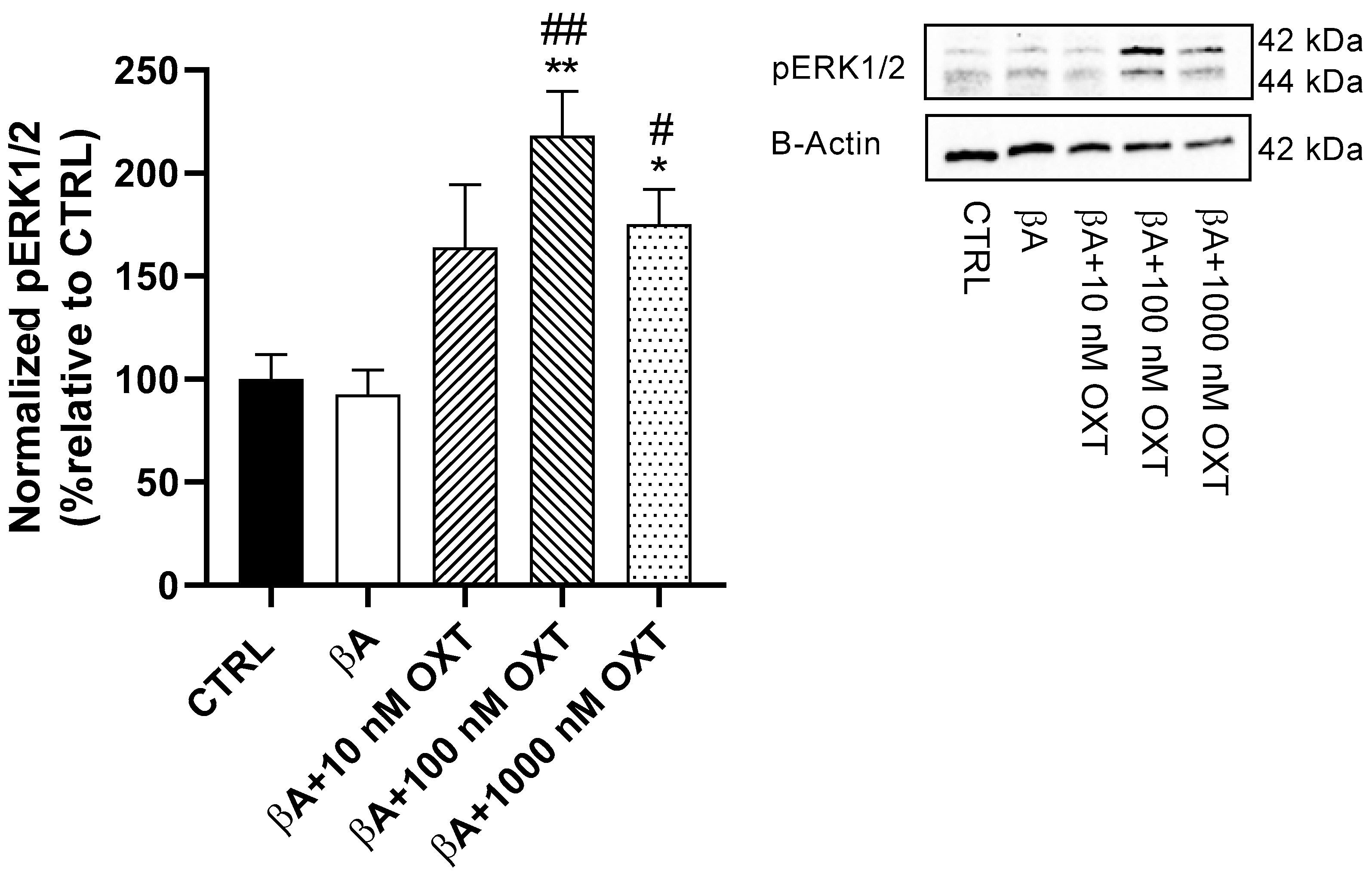 Oxytocin Protects PC12 Cells Against β-Amyloid-Induced Cell Injury