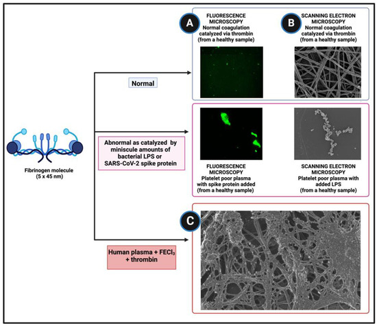A Direct Relationship Between 'Blood Stasis' and Fibrinaloid
