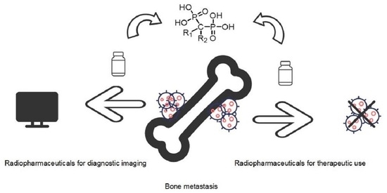 Theranostics of Bone Metastases: The Role and Prospects of ...