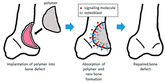Biodegradable Polymers as Drug Delivery Systems for Bone Regeneration
