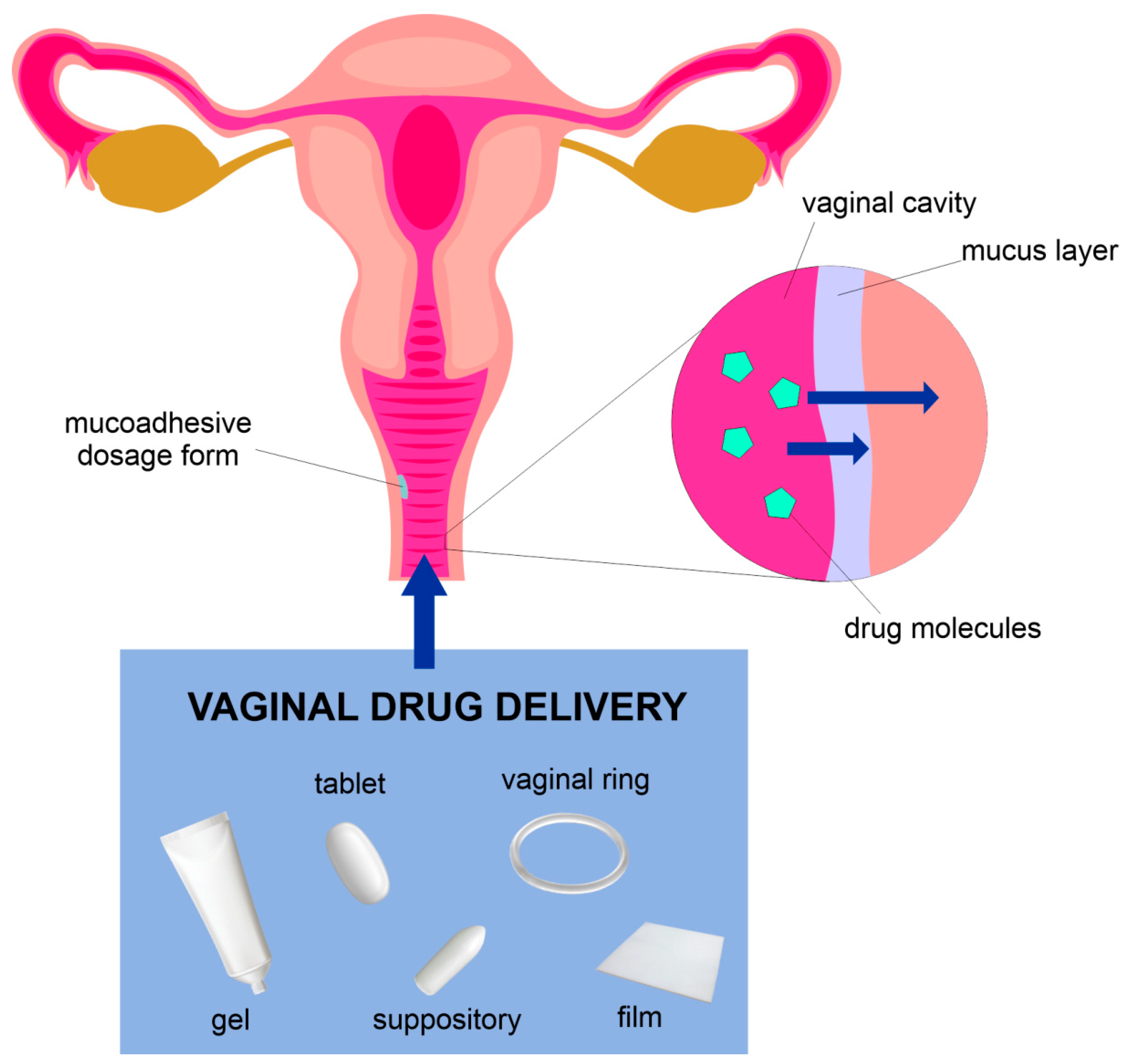 Vaginal discharge (Chapter 40) - Gynaecology: Evidence-Based Algorithms