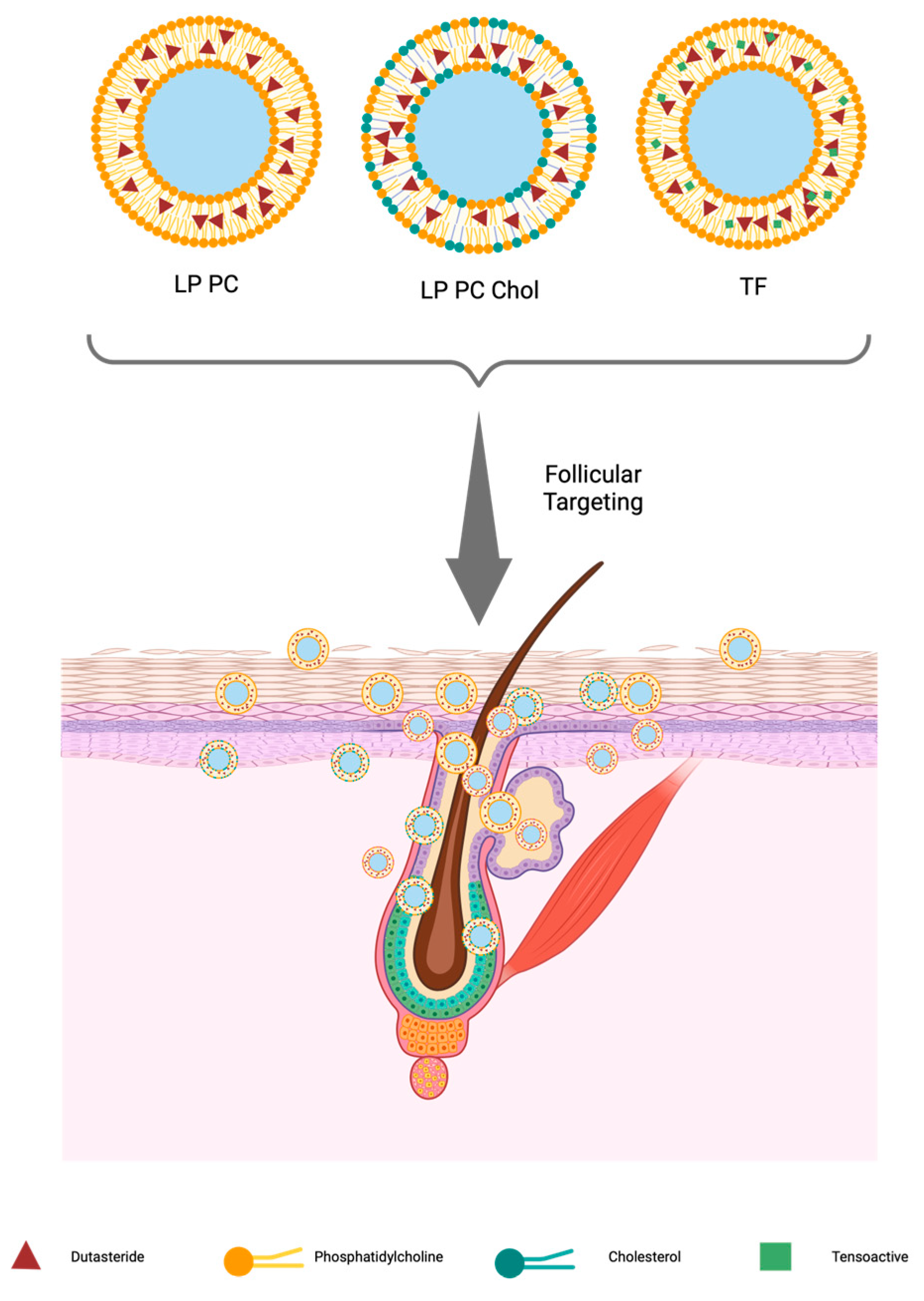 Dutasteride prevents hair loss Dutasteride prevents hair loss