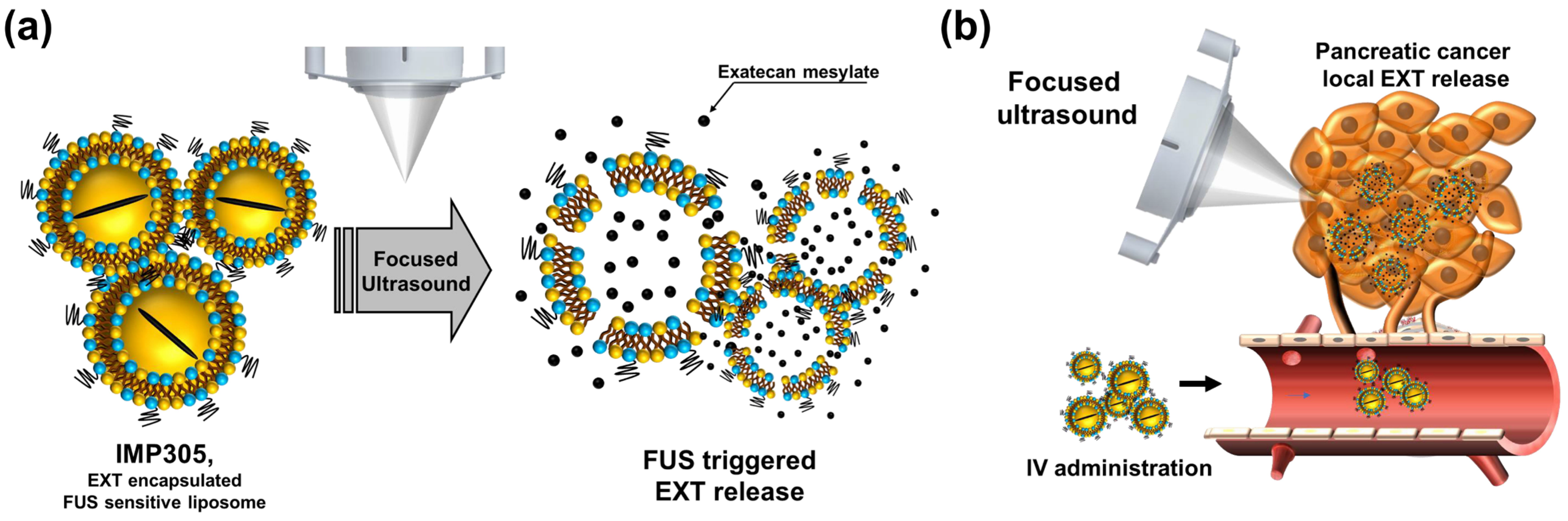 Extecan Ultrasound-Sensitive Liposomal Exatecan for Tumor-Specific Drug Release ...