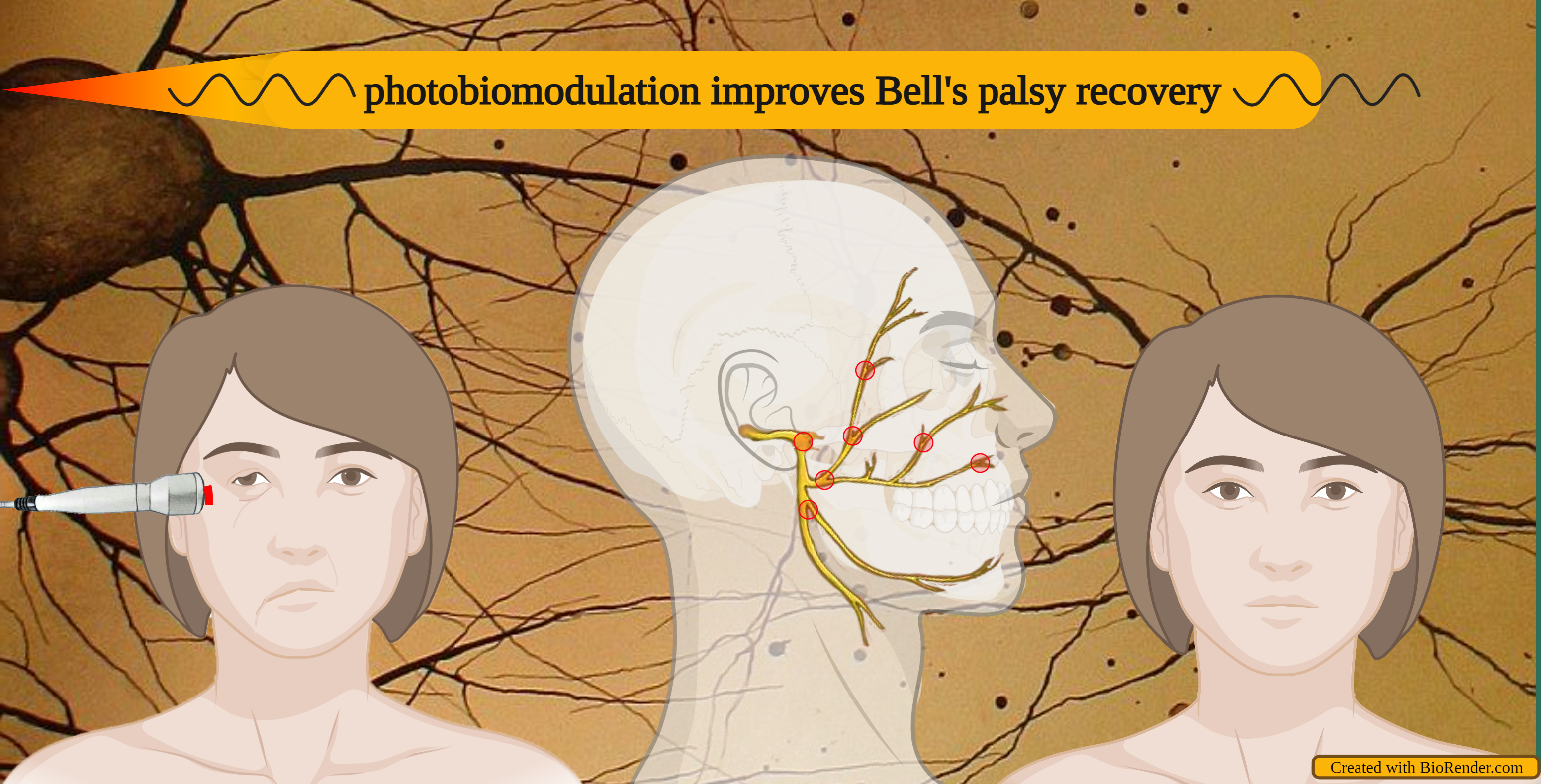 Electrical muscle stimulation for bell's palsy 