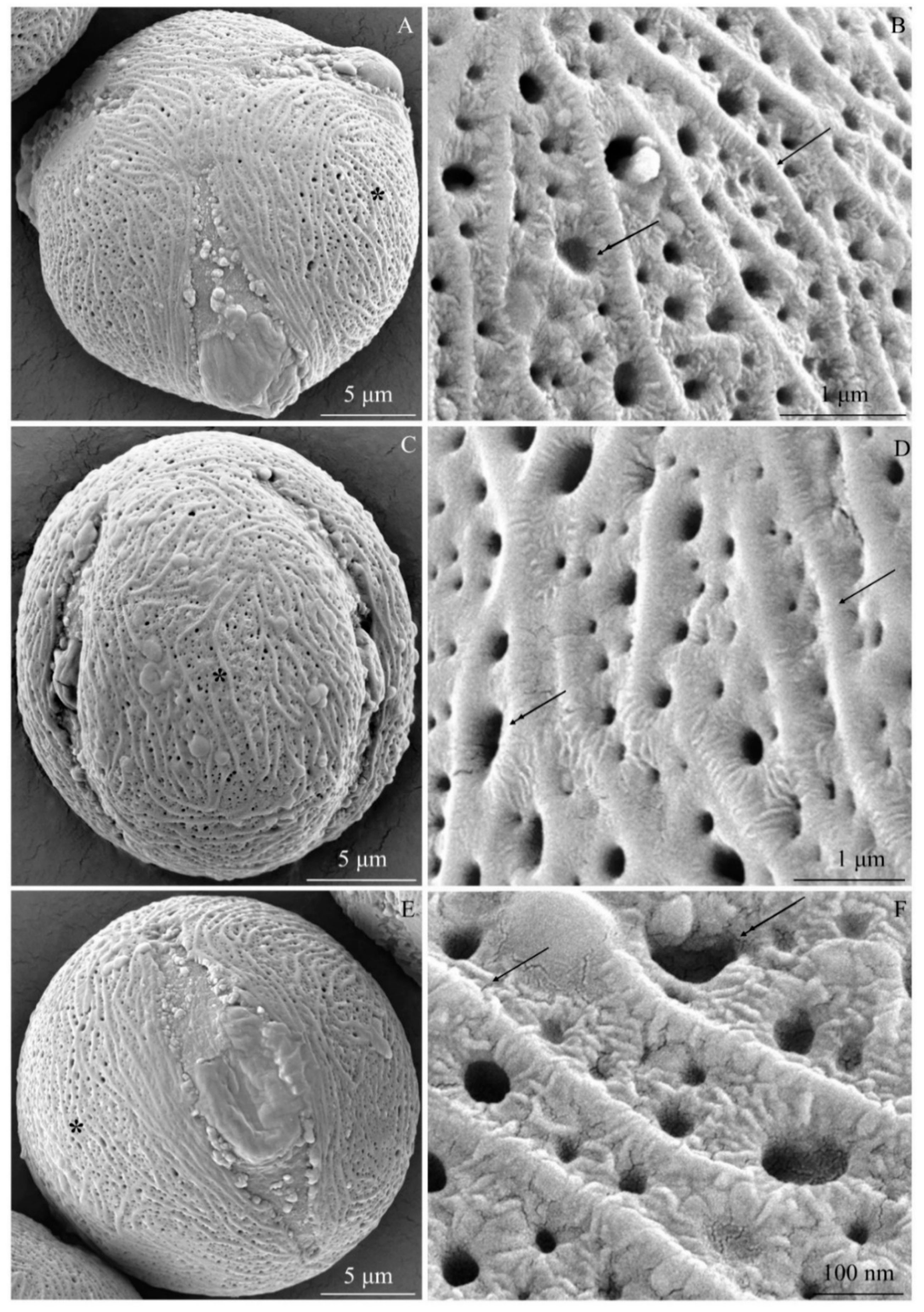 ラズベリー Comparison of the Micromorphology and Ultrastructure of
