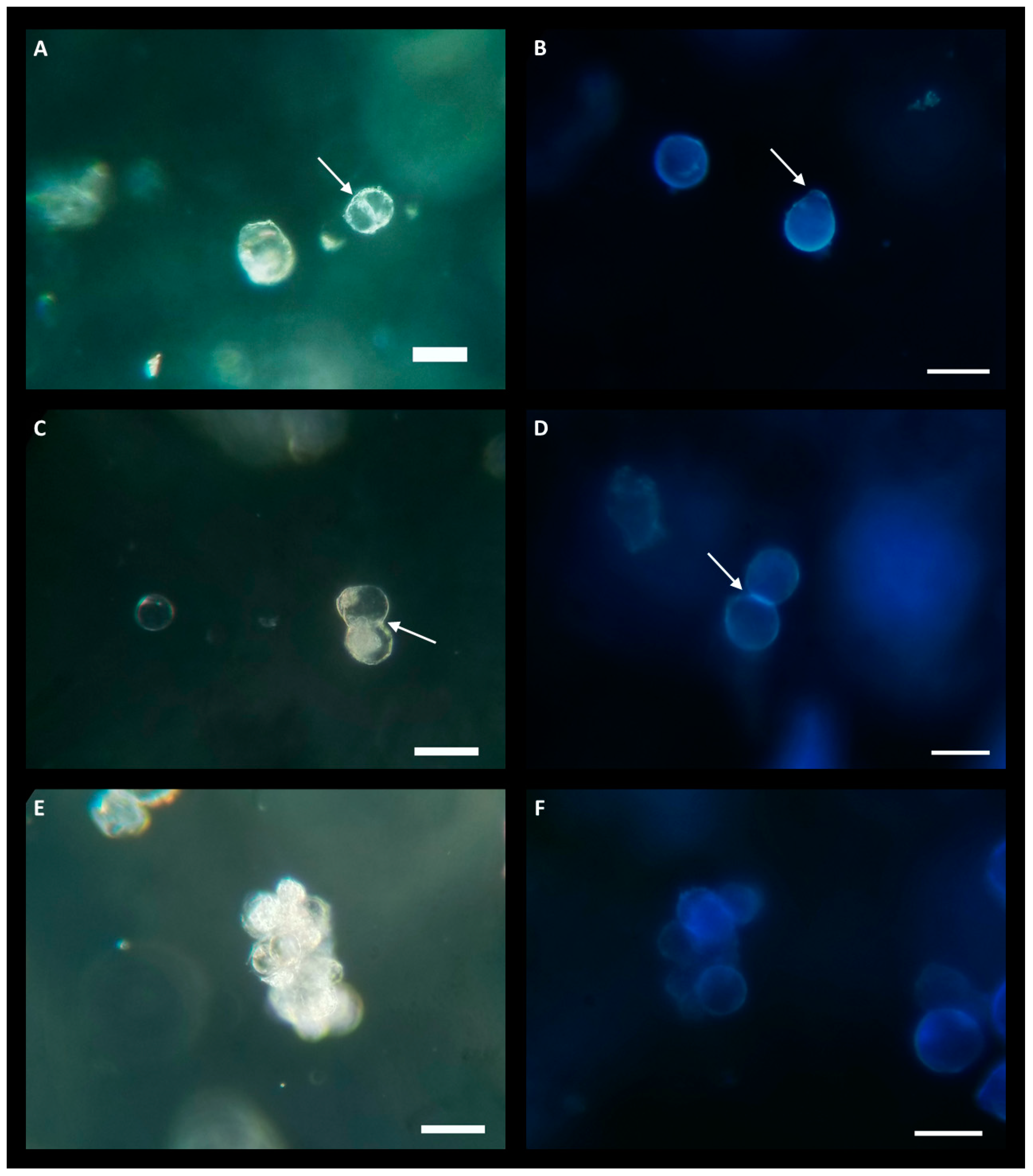 Plants | Free Full-Text | Enhancing Protoplast Isolation And Early Cell ...