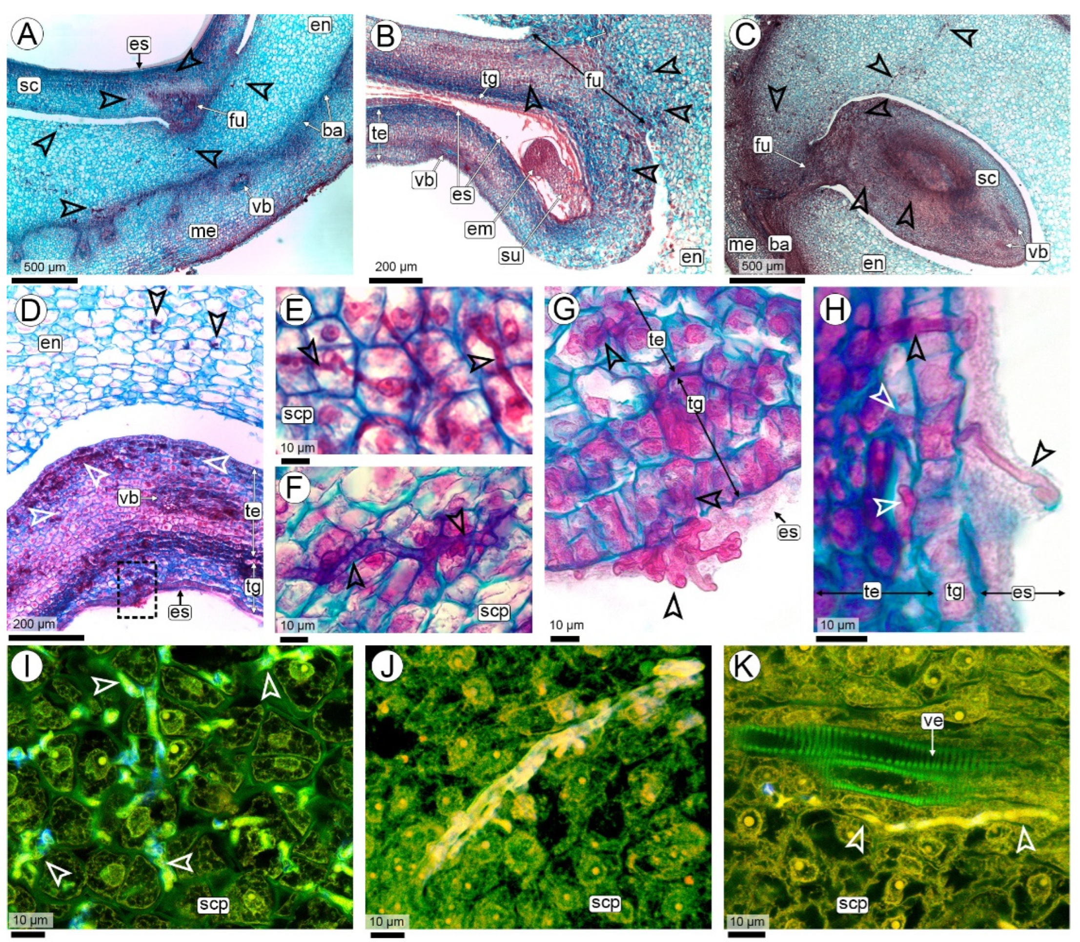 Histopathology of Thecaphora frezzii Colonization: A Histopathology of Thecaphora frezzii Colonization: A