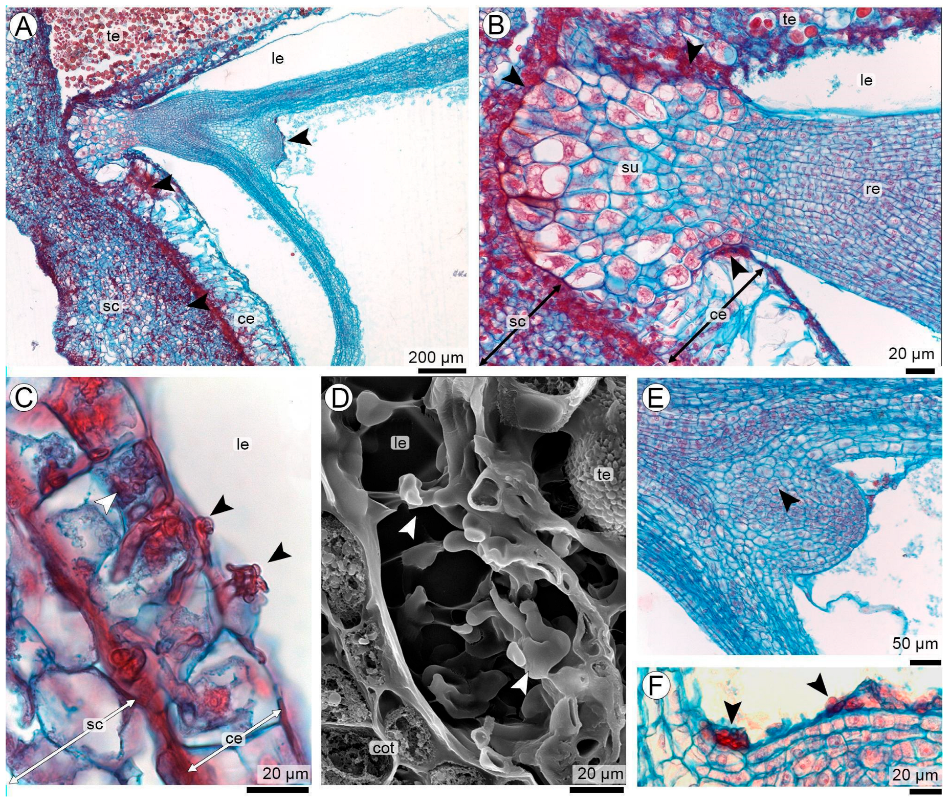 Teliosporogenesis of the Peanut Smut Fungus Thecaphora frezzii in ...