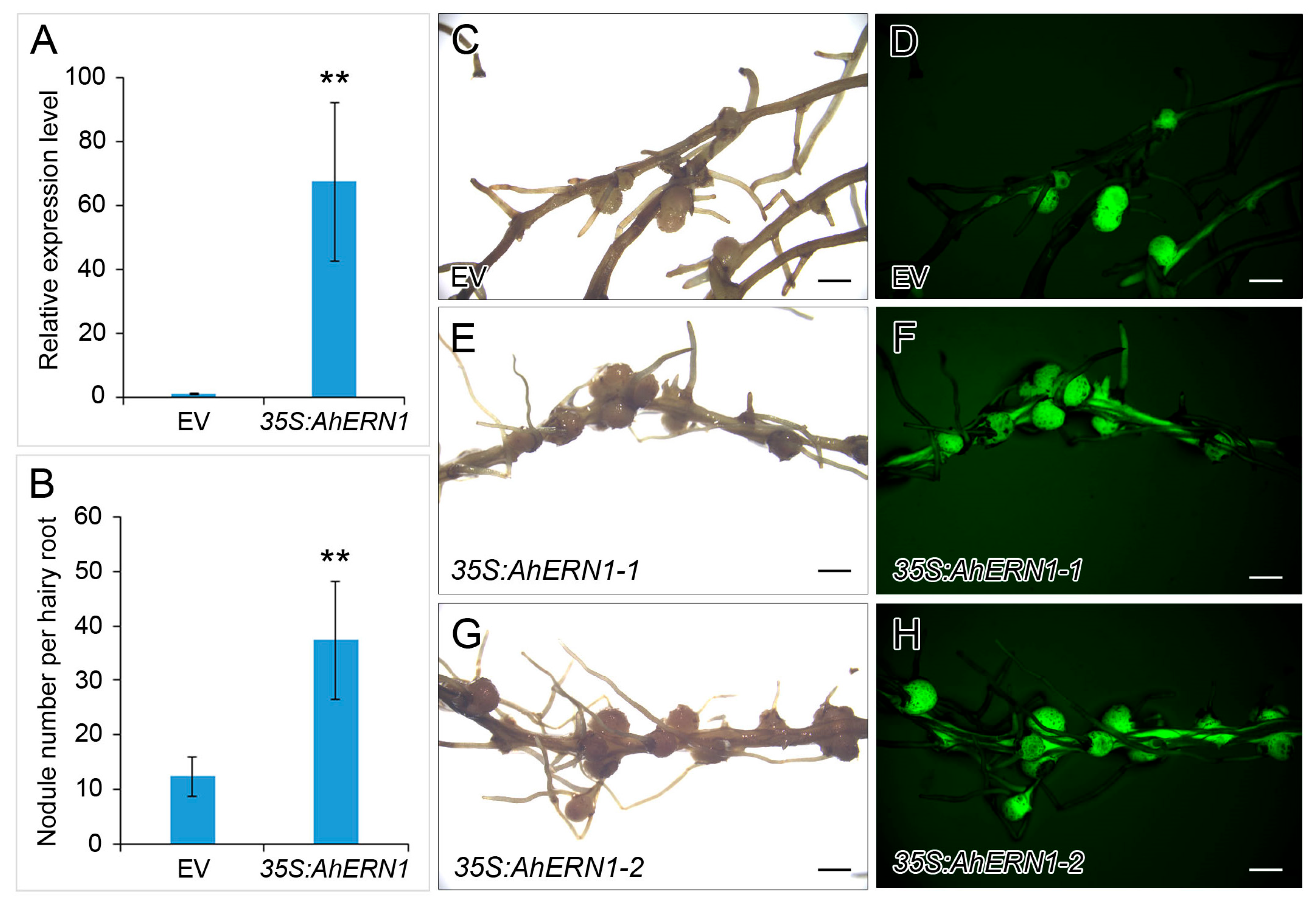 Transcriptomic Analysis Reveals the Role of AhERN1 in Peanut Nodulation