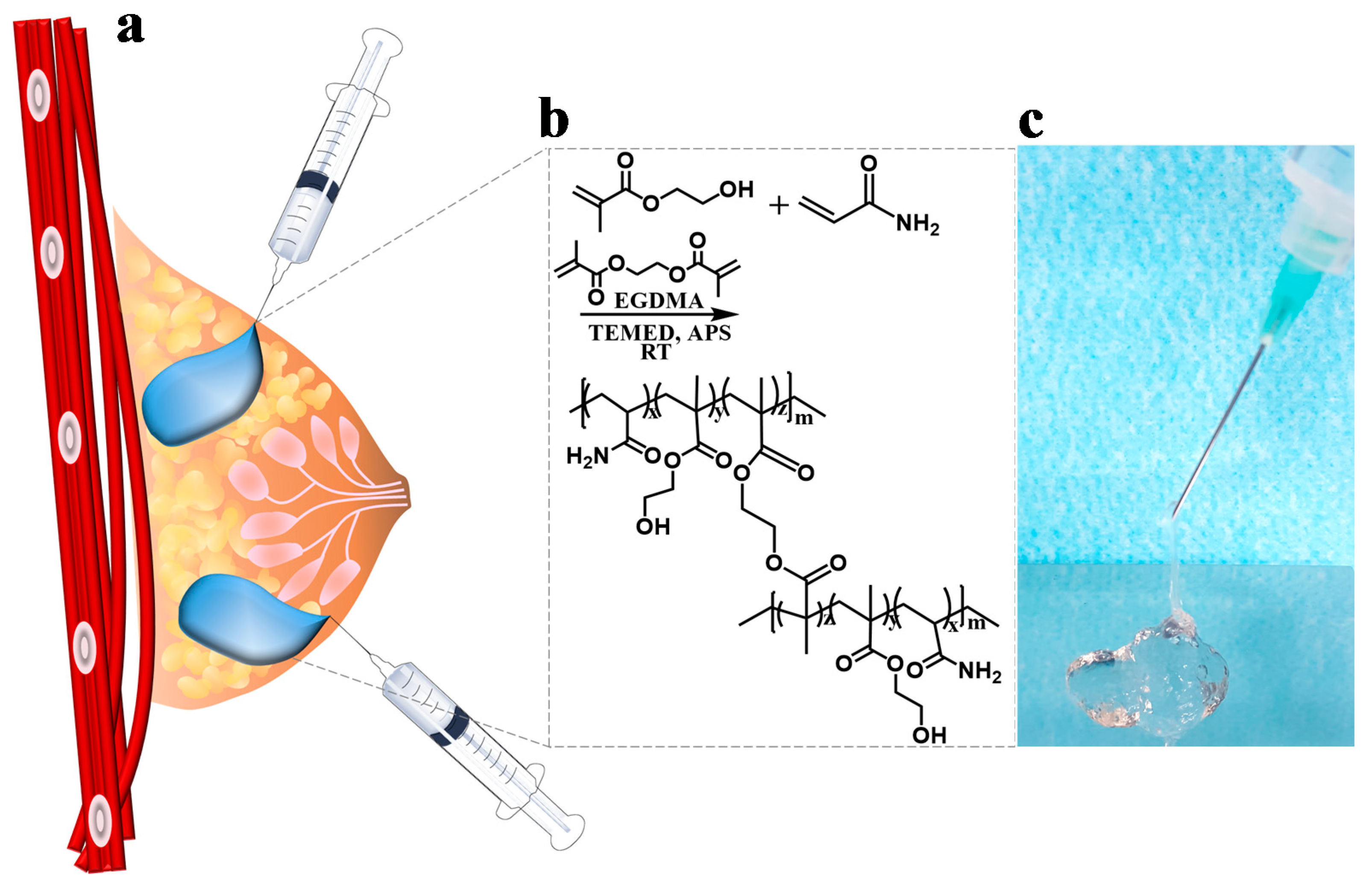 systematisch Lunch Gearceerd Polymers | Free Full-Text | Development of Poly(HEMA-Am) Polymer Hydrogel  Filler for Soft Tissue Reconstruction by Facile Polymerization