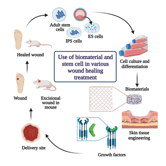 Polymers | Free Synergistic Effect Biomaterial and Stem Cell for Skin Tissue Engineering in Cutaneous Wound Healing: Concise Review