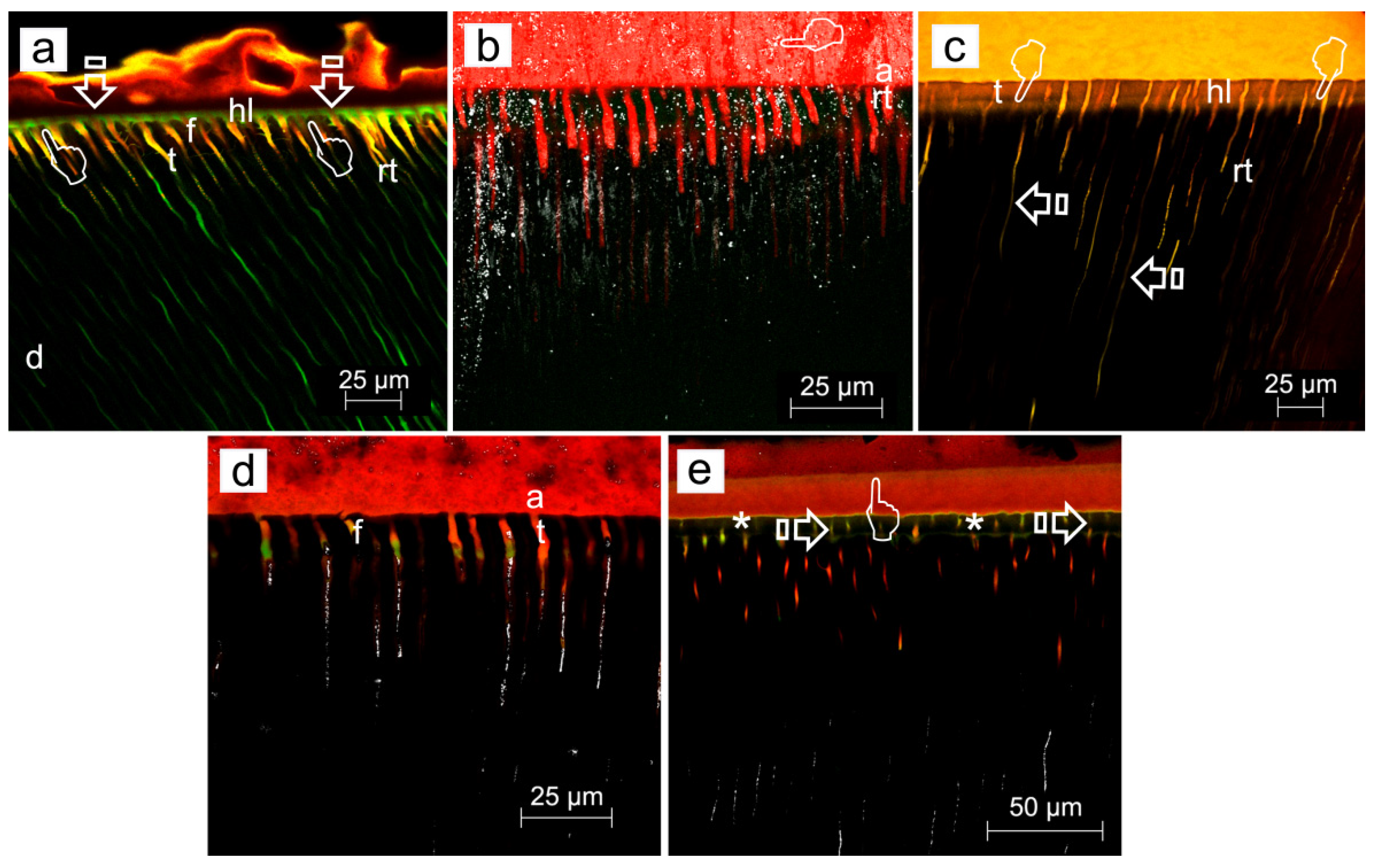 Light micrographs showing several regions of the dentin-pulp interface