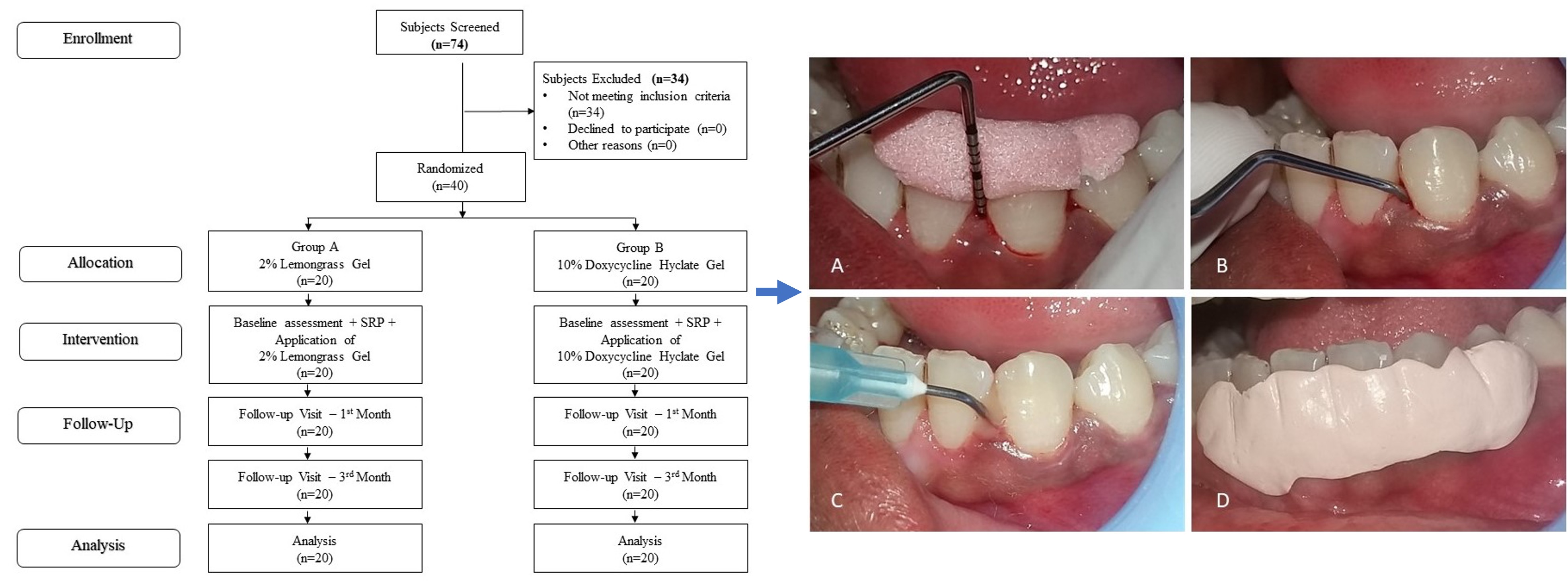 Should I Get Root Planing and Scaling (“deep cleaning”) from the General  Dentist or Periodontist?: Willow Glen Dental Specialists: Periodontists