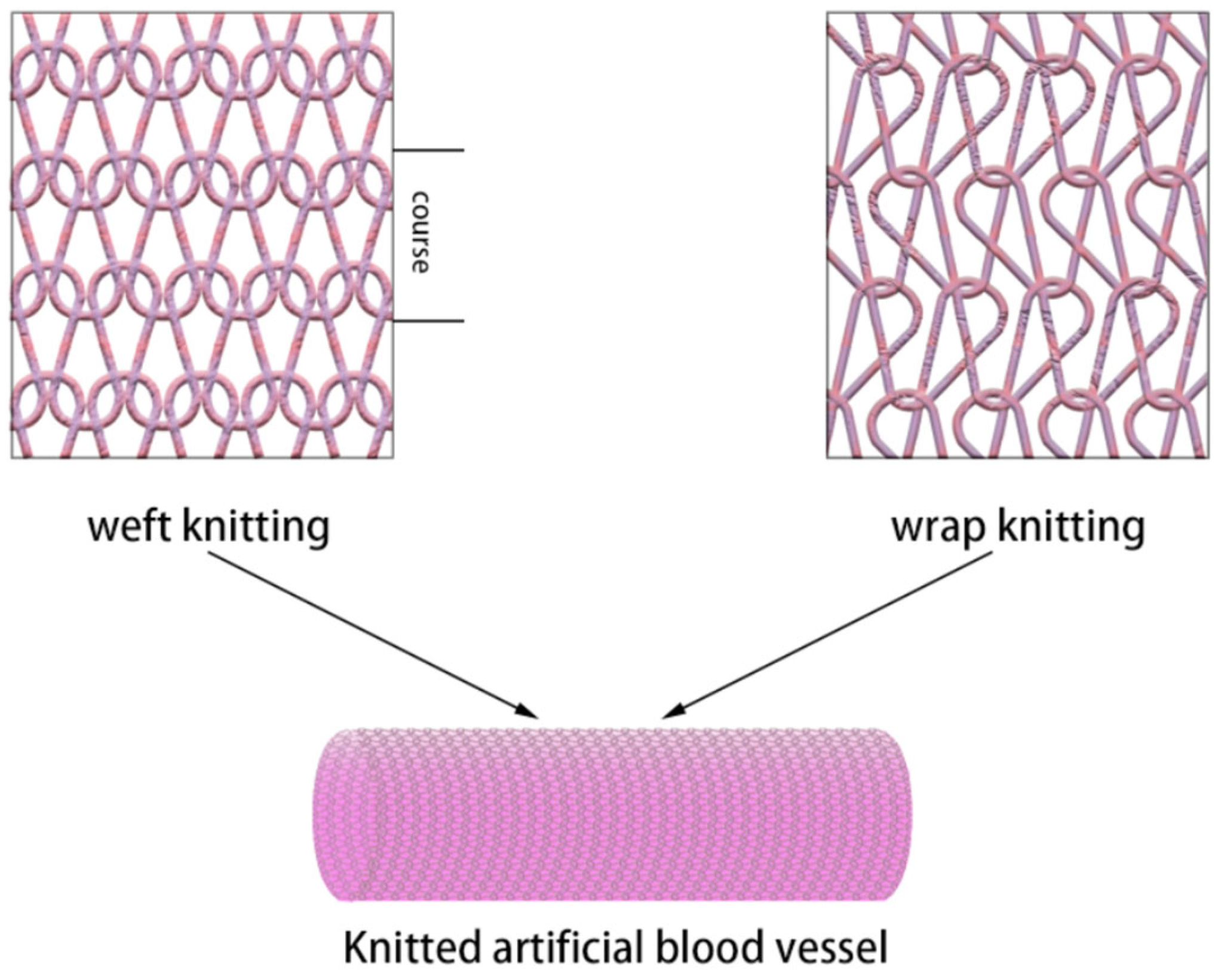 Structural design patterns of a woven Dacron ® graft.
