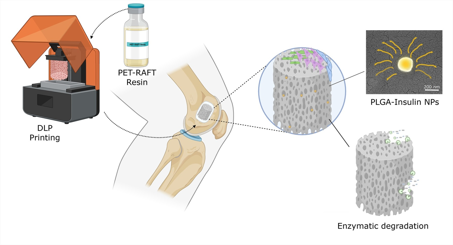 Engineering Porous PET-RAFT Scaffolds with PLGA–Insulin Nanoparticles ...