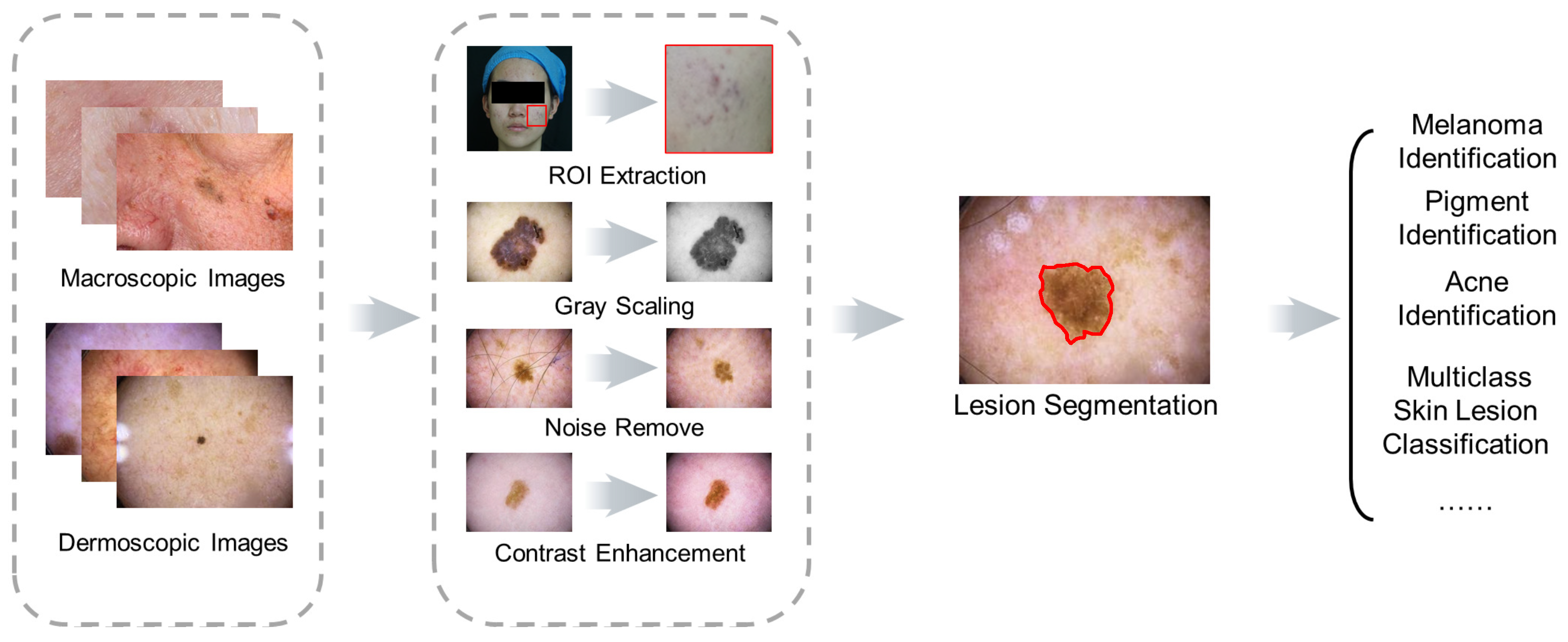 research paper on skin diseases using machine learning