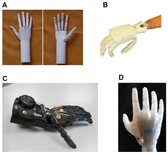 https://pub.mdpi-res.com/prosthesis/prosthesis-03-00003/article_deploy/html/images/prosthesis-03-00003-g009.png?1611900598