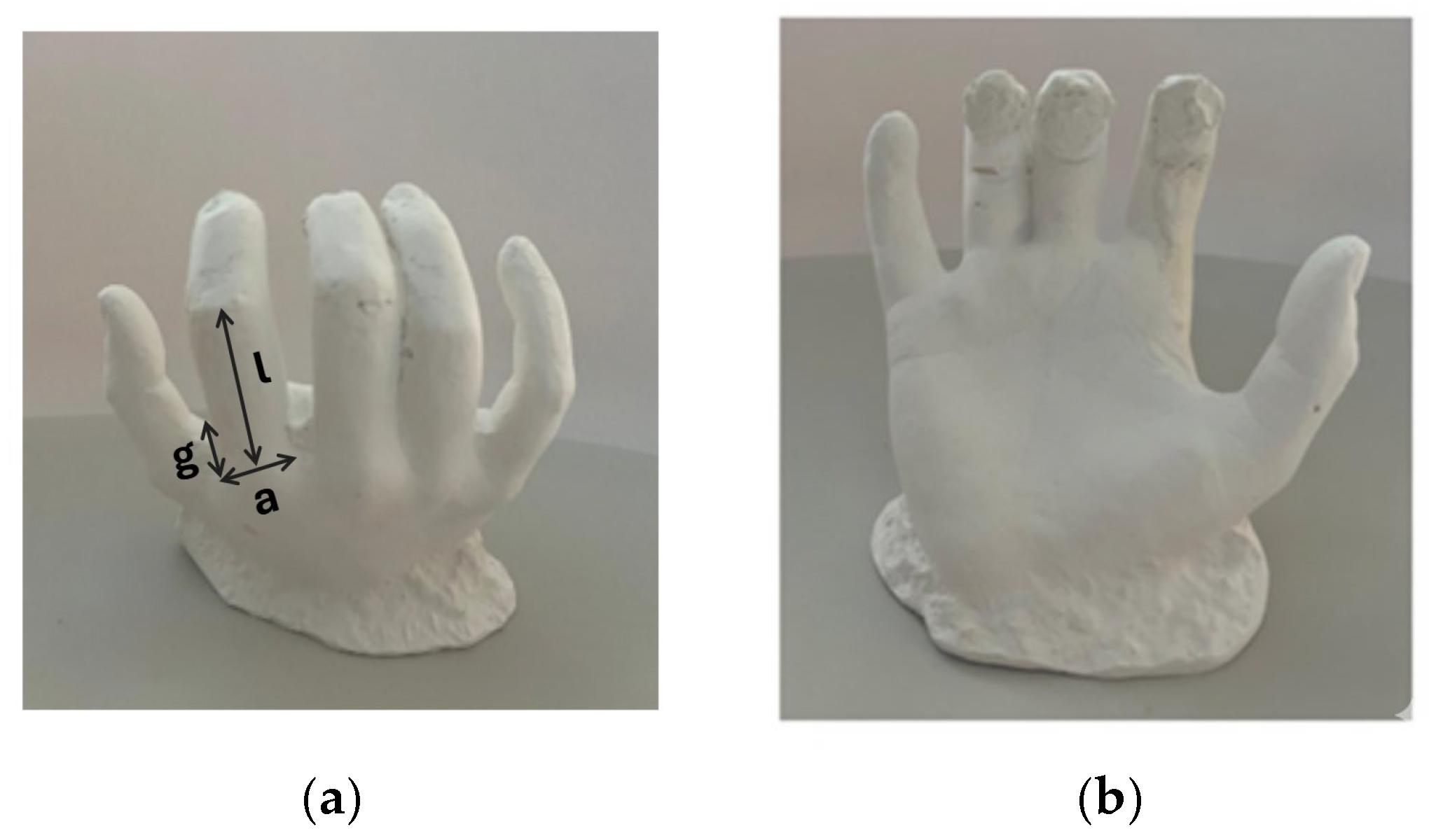 Development of a Modular Bionic Hand with Intuitive Control and Thumb ...
