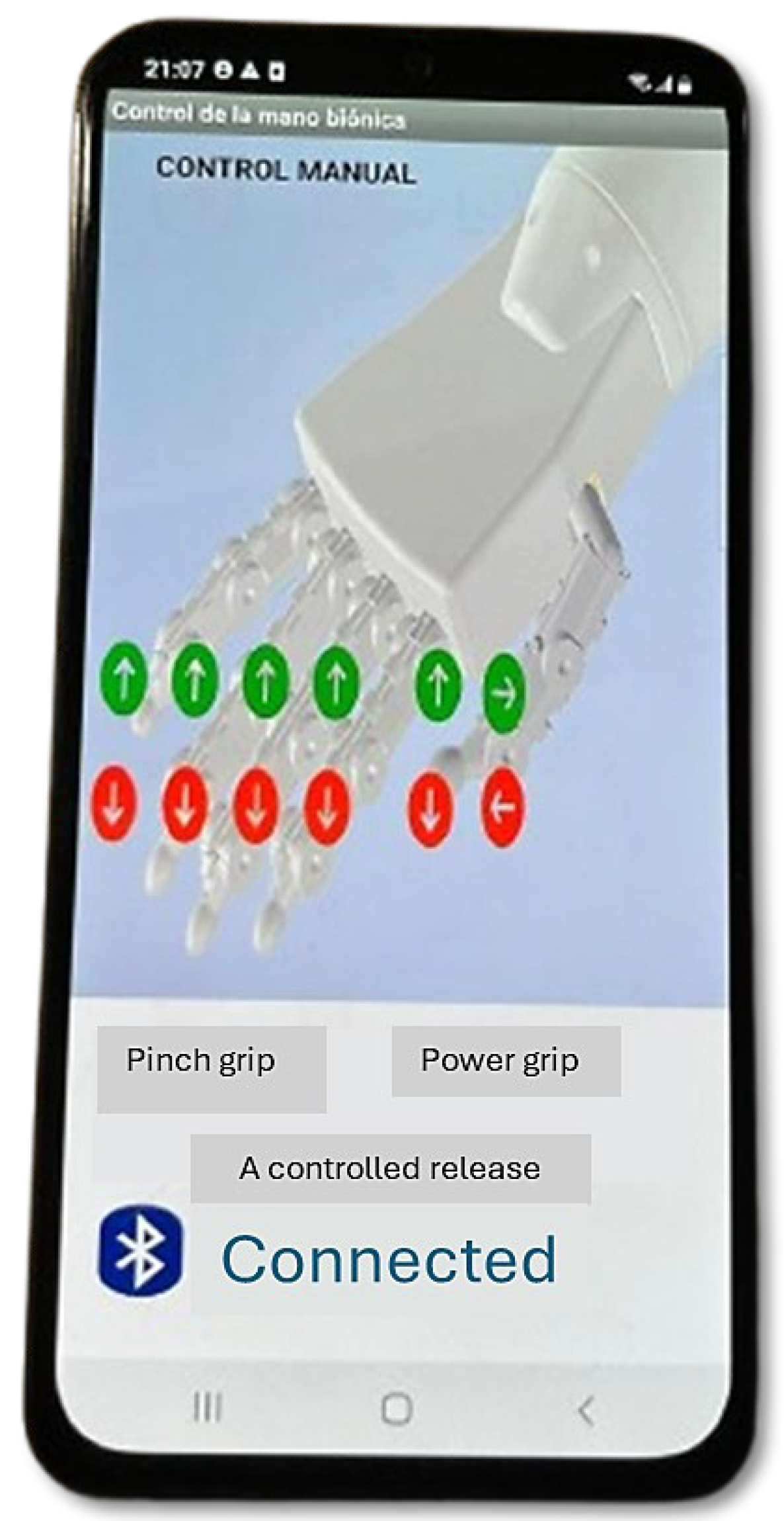 Development of a Modular Bionic Hand with Intuitive Control and Thumb ...