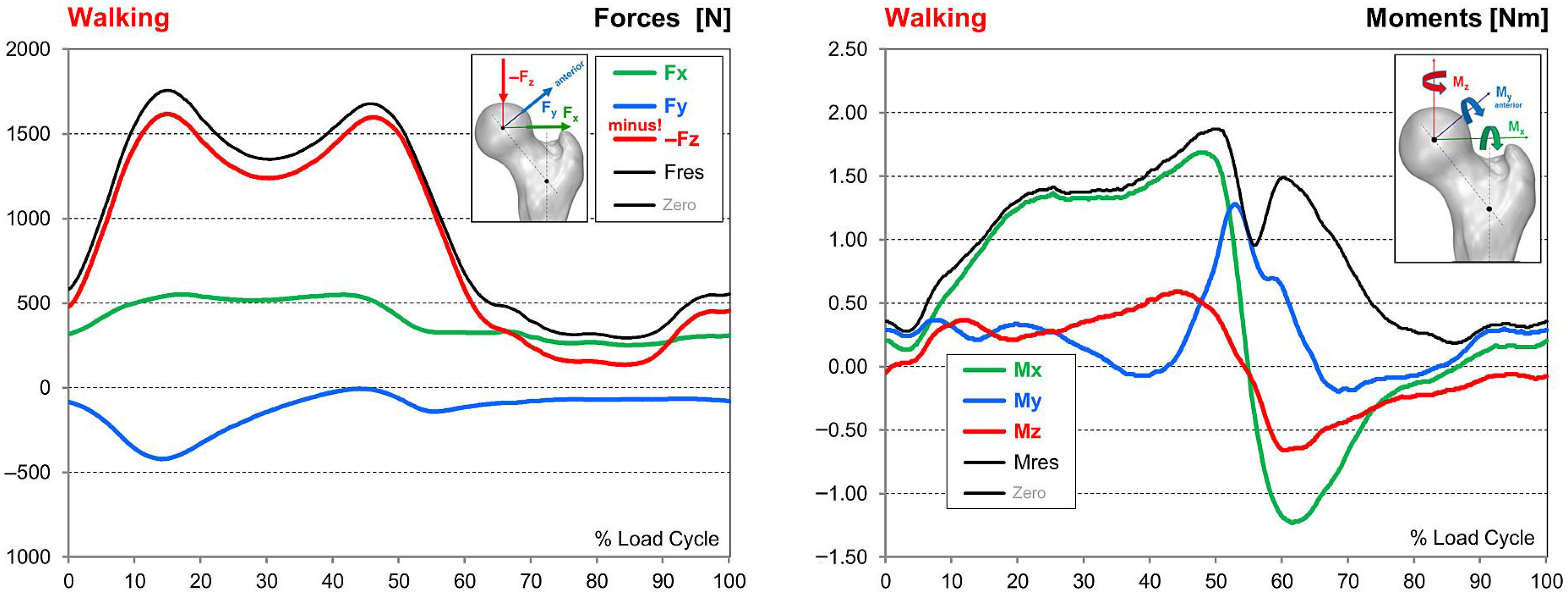 Finite Element Analysis of Collared Hip Prosthesis Cross-Sections Under ...