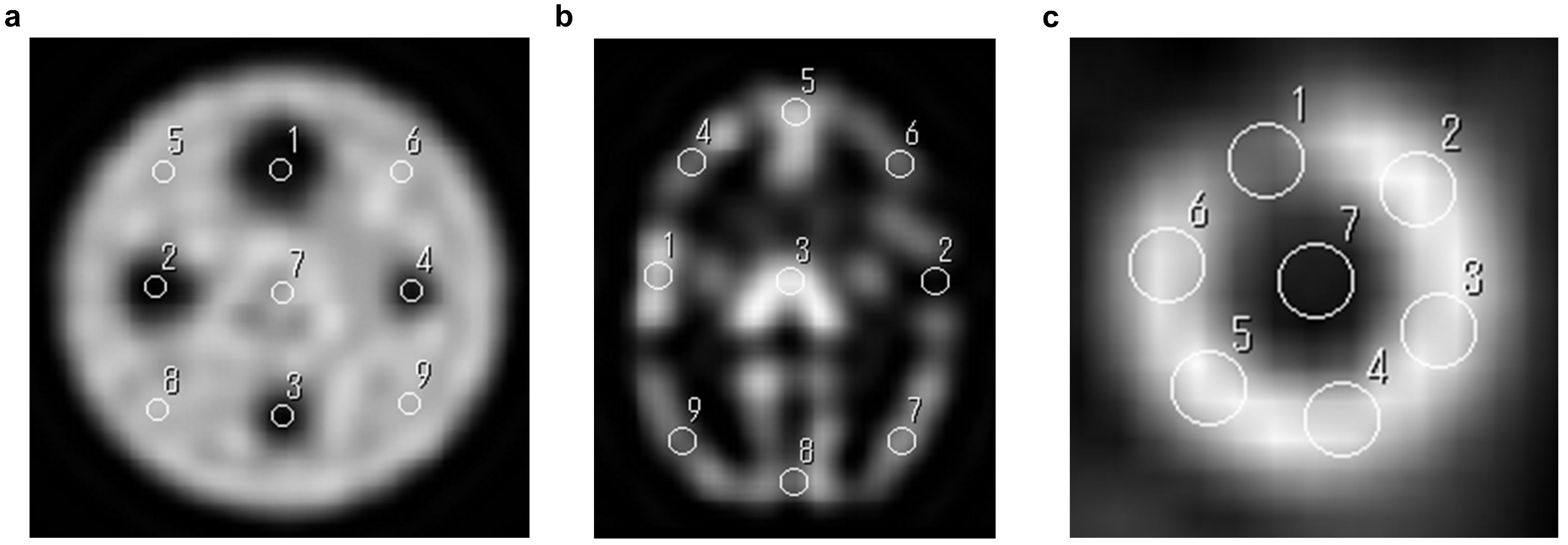 Evaluation of Scatter Correction Methods in SPECT Images: A Phantom ...
