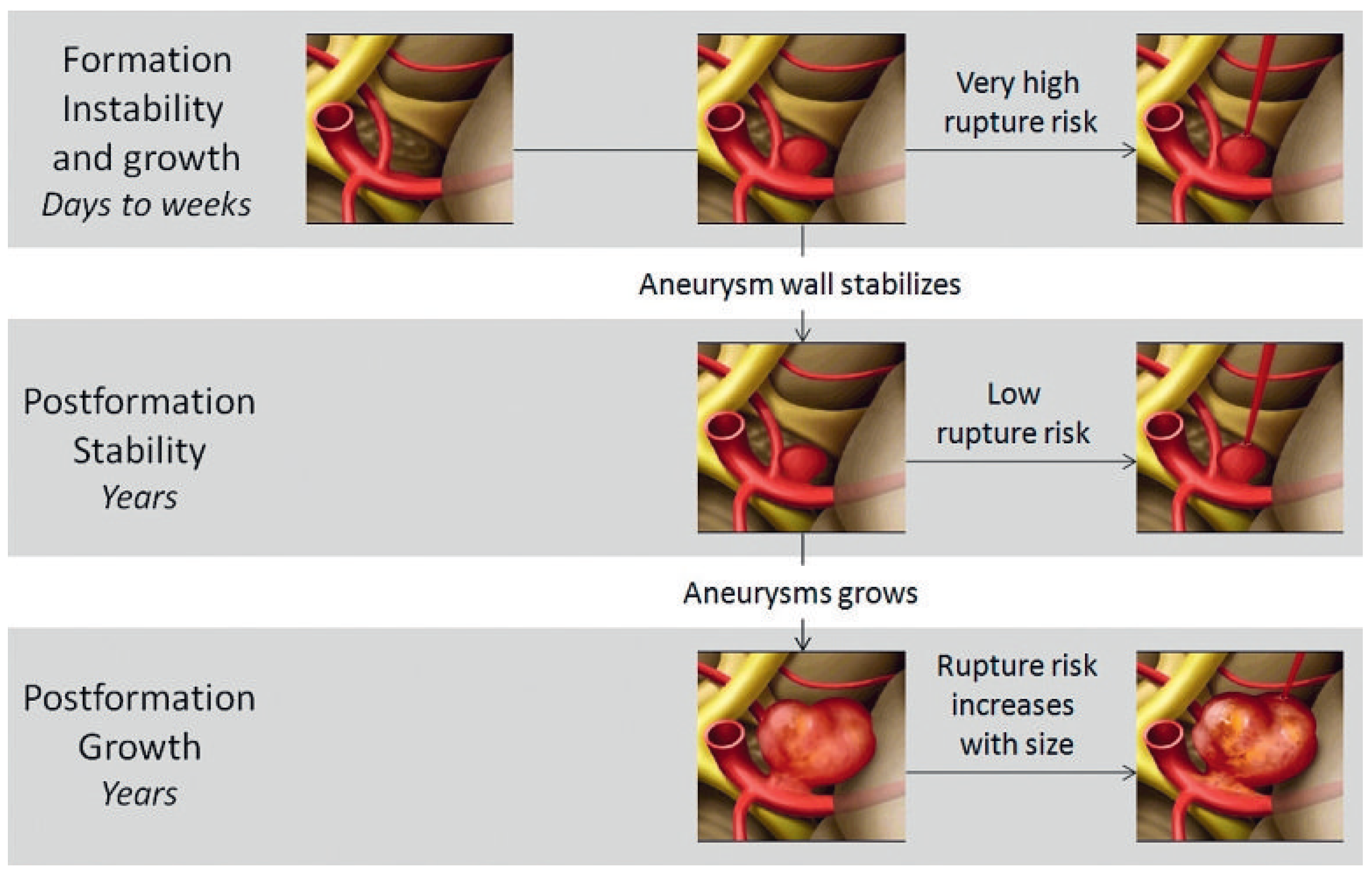 Intracranial aneurysms: new aspects of formation, rupture and outcome