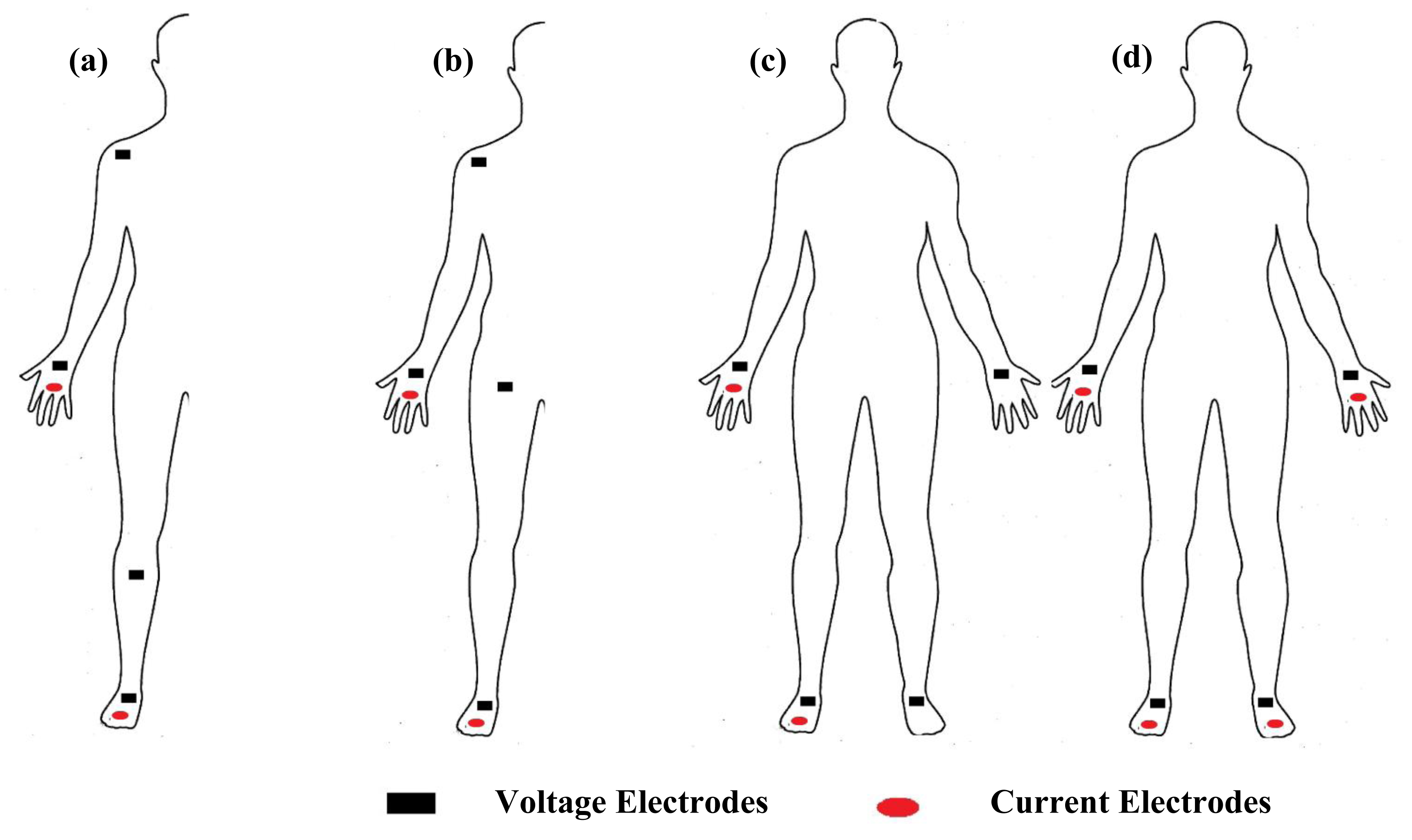 Bioelectrical Impedance Analysis in Monitoring of the Clinical