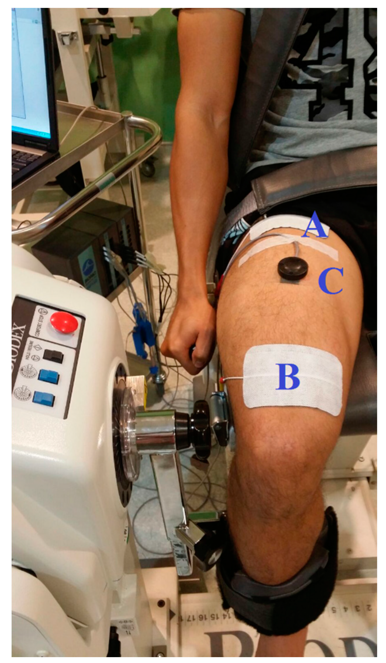 Neuromuscular Electrical Stimulation (NMES) After Knee Replacement 