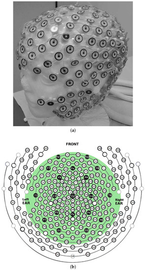 Developmental trajectories of EEG aperiodic and periodic