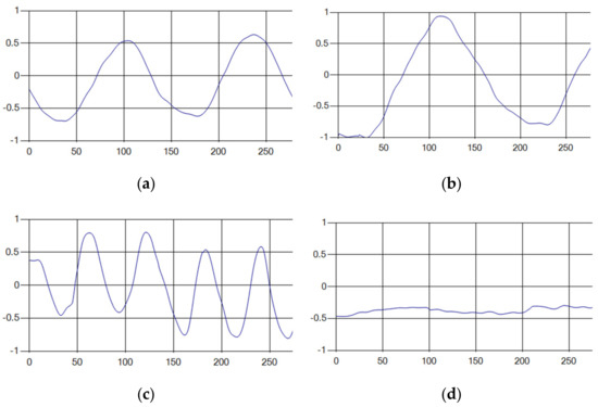 Hyperparameter Optimization Method Based on Harmony Search Algorithm to ...