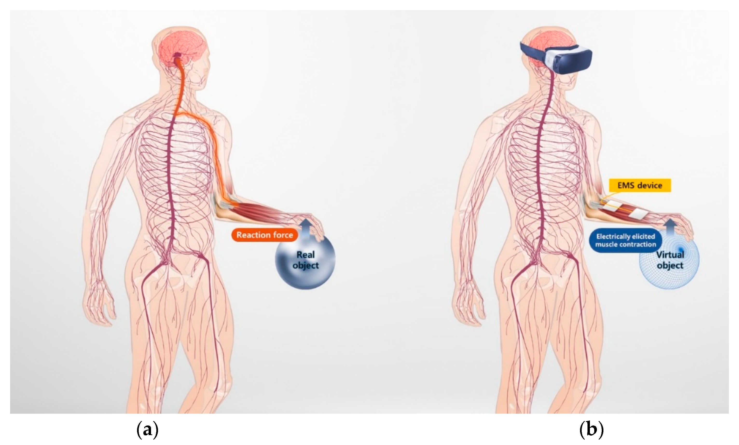 Muscular Stimulation – The World of Implantable Devices
