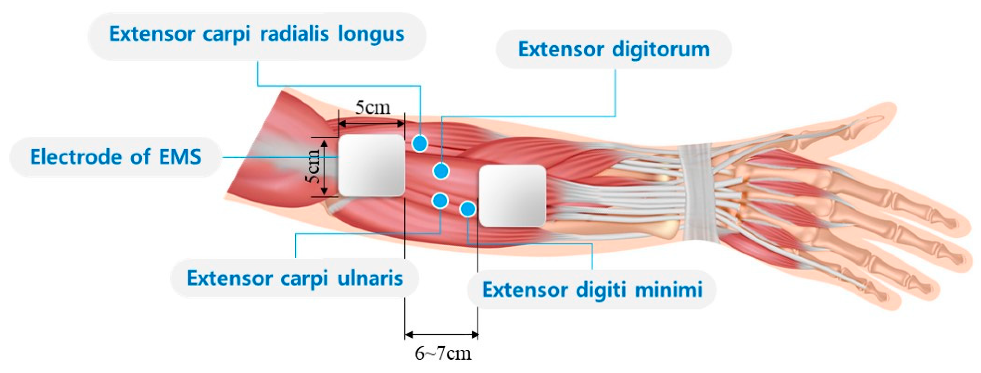 Electrically Elicited Force Response Characteristics Of Forearm Electrically Elicited Force Response Characteristics Of Forearm