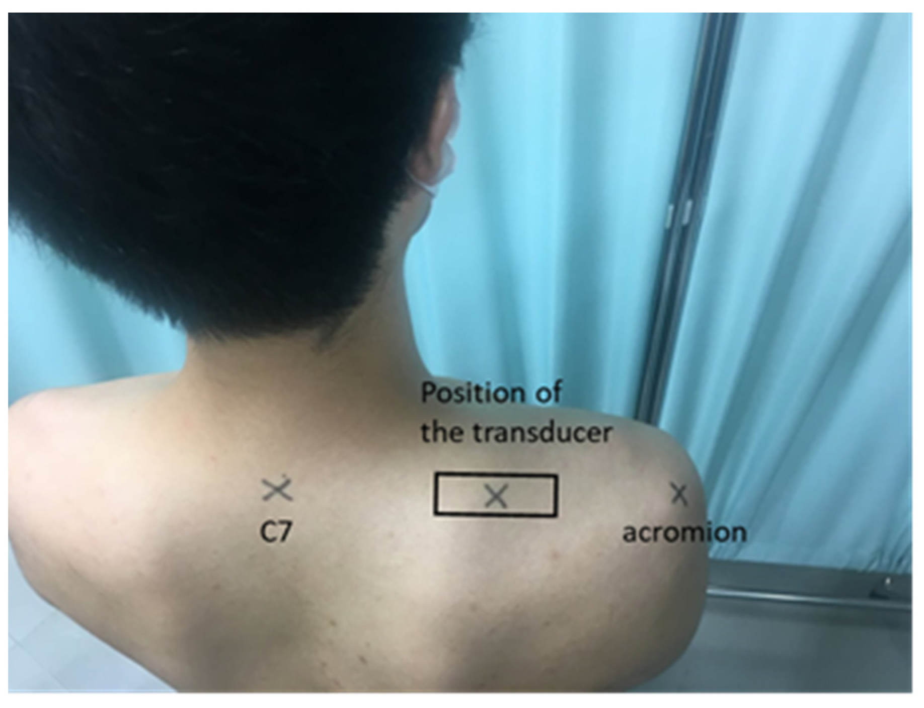Verdraaiing Vervelend officieel Sensors | Free Full-Text | Reliability of Trapezius Muscle Hardness  Measurement: A Comparison between Portable Muscle Hardness Meter and  Ultrasound Strain Elastography