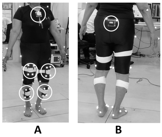 Estimation of the External Knee Adduction Moment during Gait Using an ...