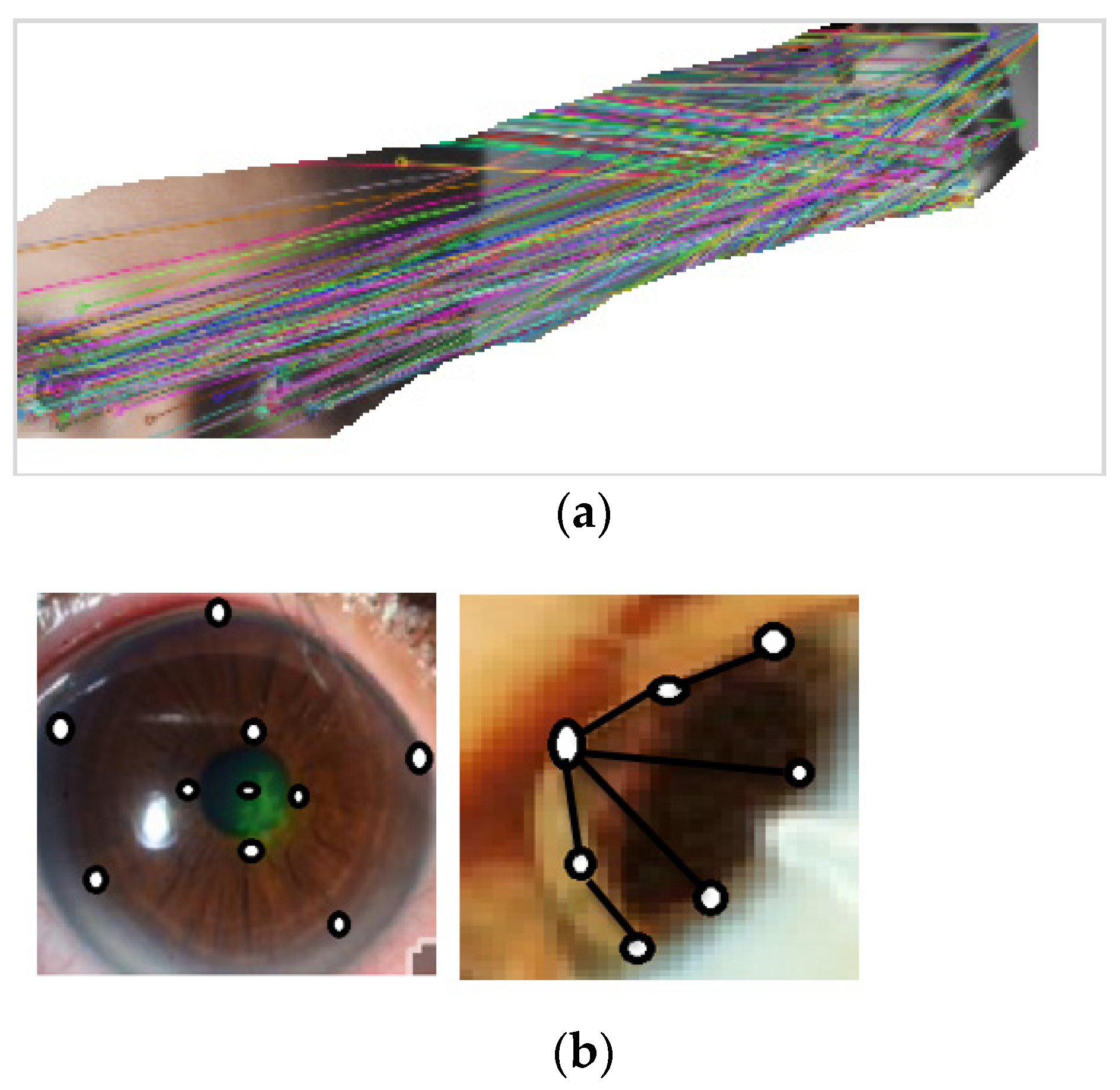 Automated Keratoconus Detection By 3D Corneal Images Reconstruction Automated Keratoconus Detection By 3D Corneal Images Reconstruction