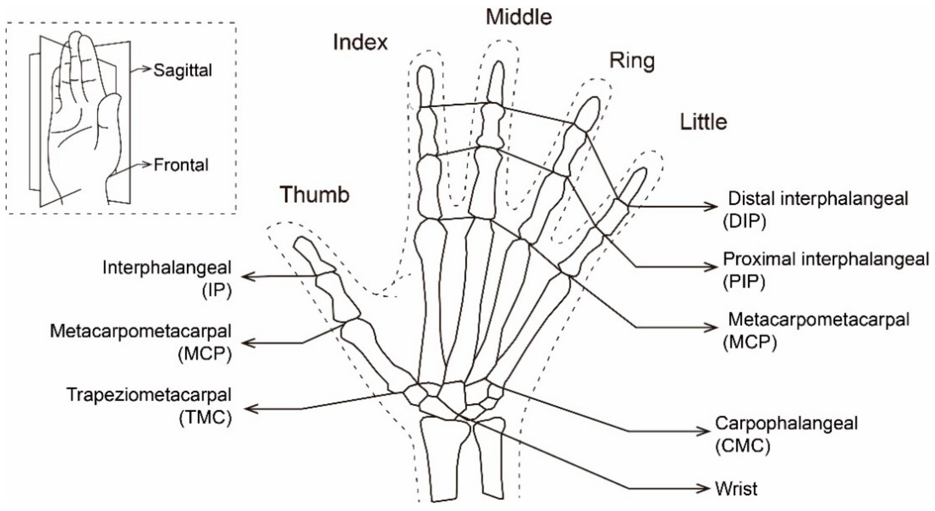 Linear trend contrast (index finger < middle finger < ring finger