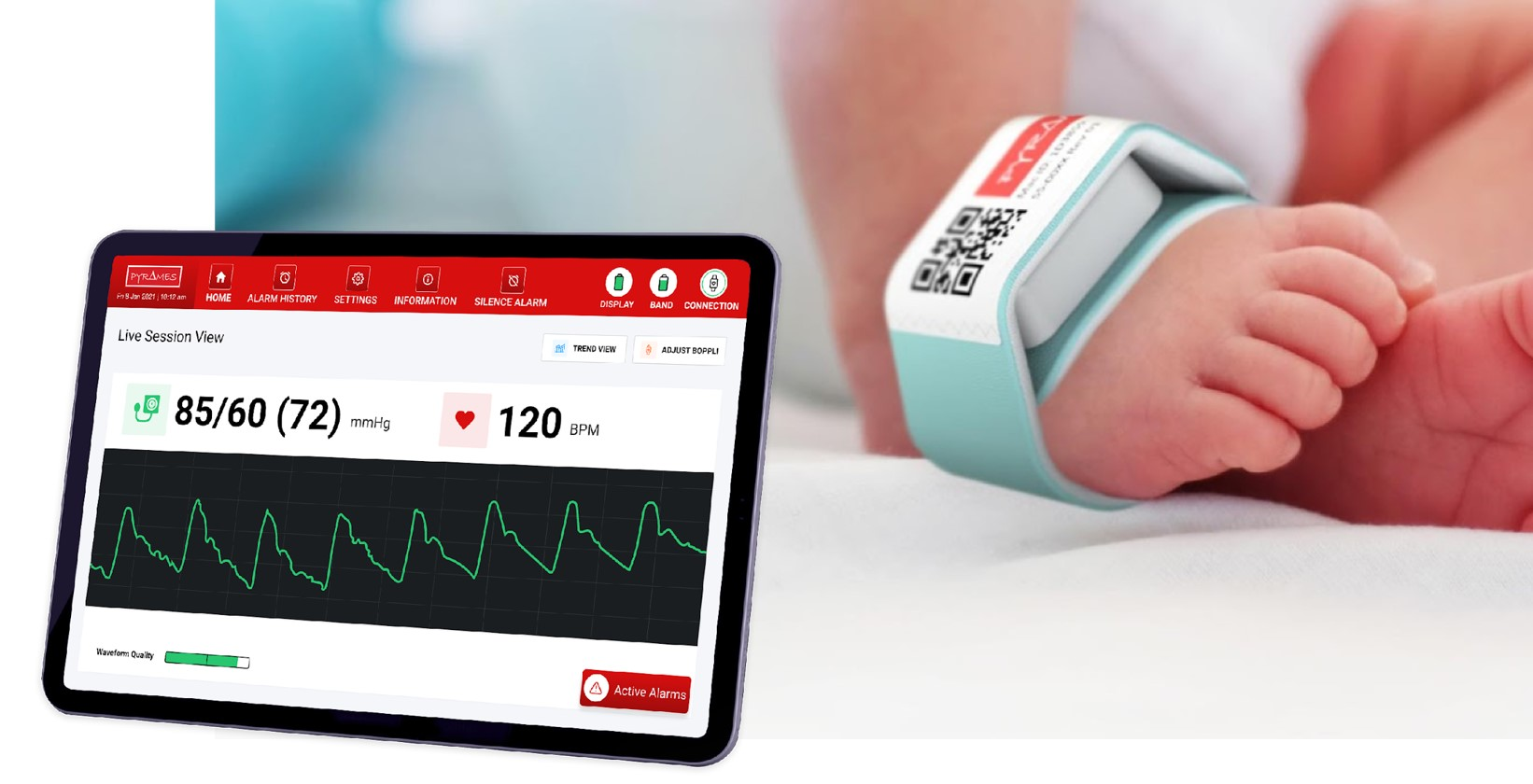 Non-invasive continuous blood pressure monitoring: a review of current  applications