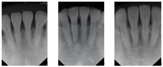 Apex Dental Sensors Review : Boosting Dental Efficiency with Powerful Imaging