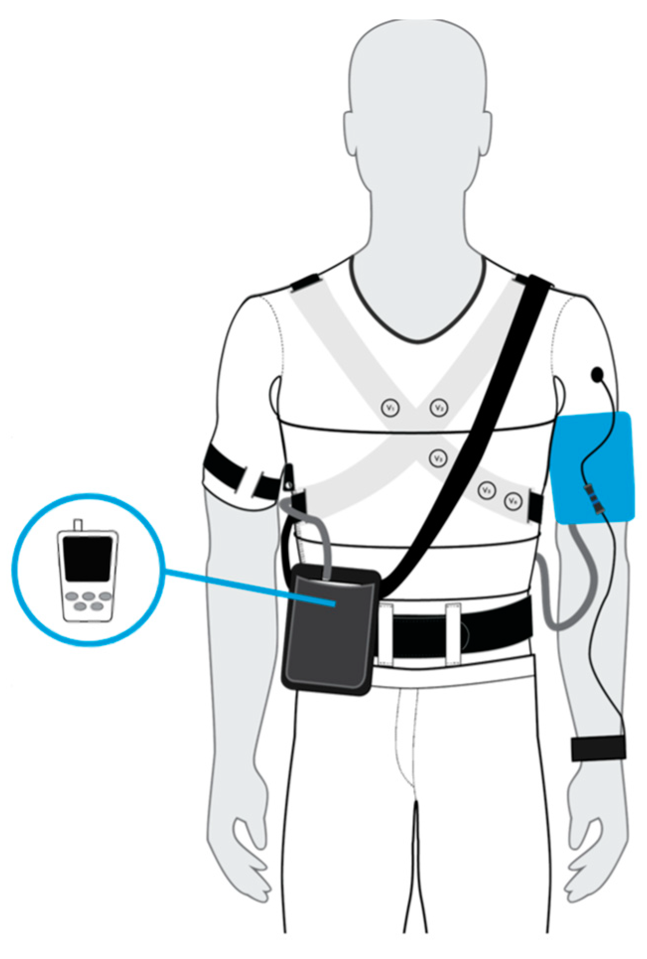 This wearable waist belt automatically adjusts pressure + corrects