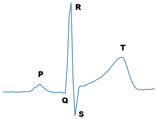 Sensors | Free Full-Text | Real-Time Stress Level Feedback from Raw Ecg ...