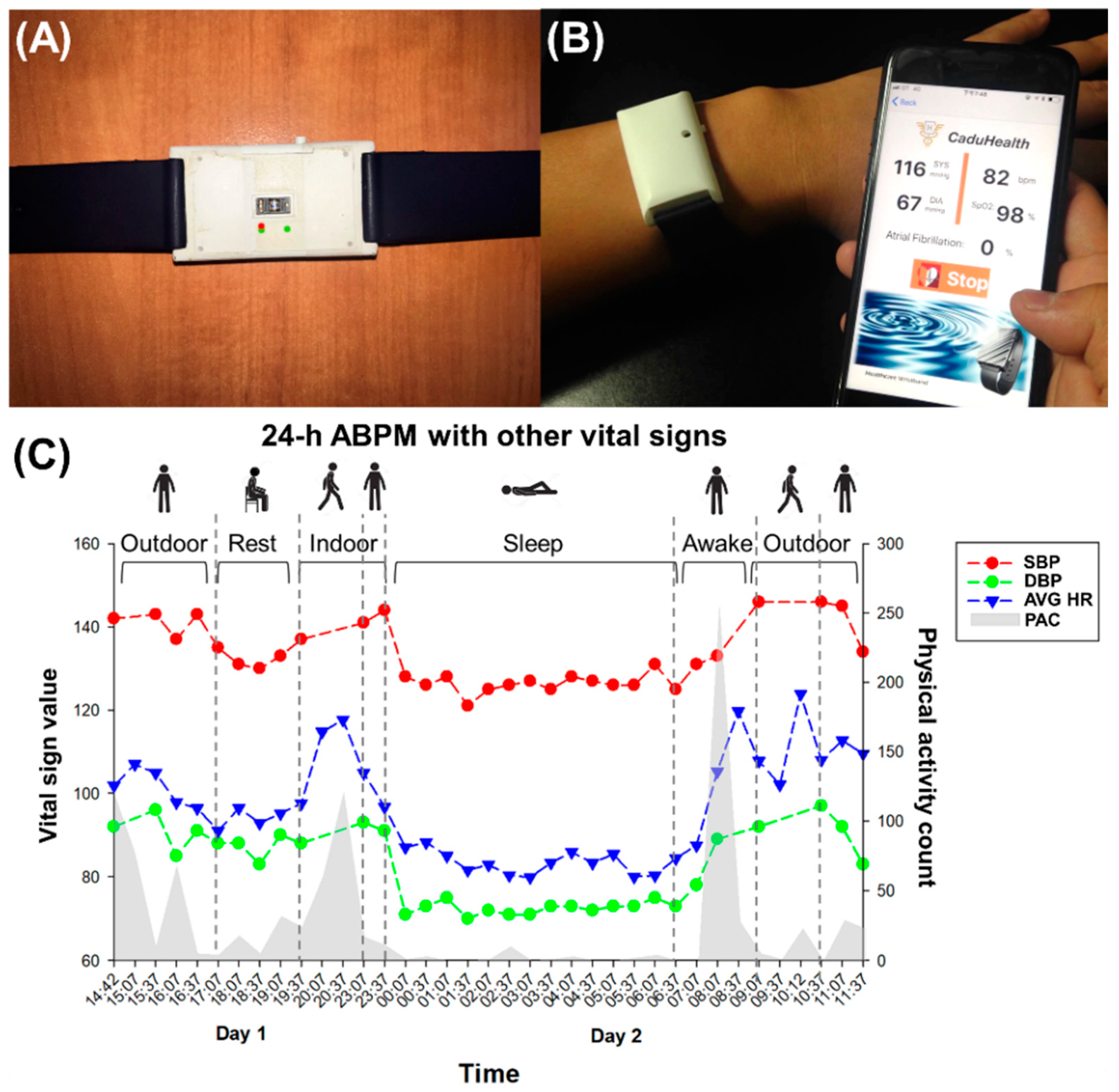 Correlation analysis of human upper arm parameters to oscillometric signal  in automatic blood pressure measurement