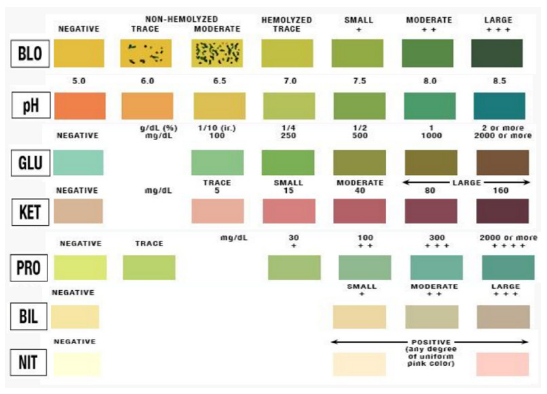 How To Interpret A Urine Dipstick Result 54 OFF
