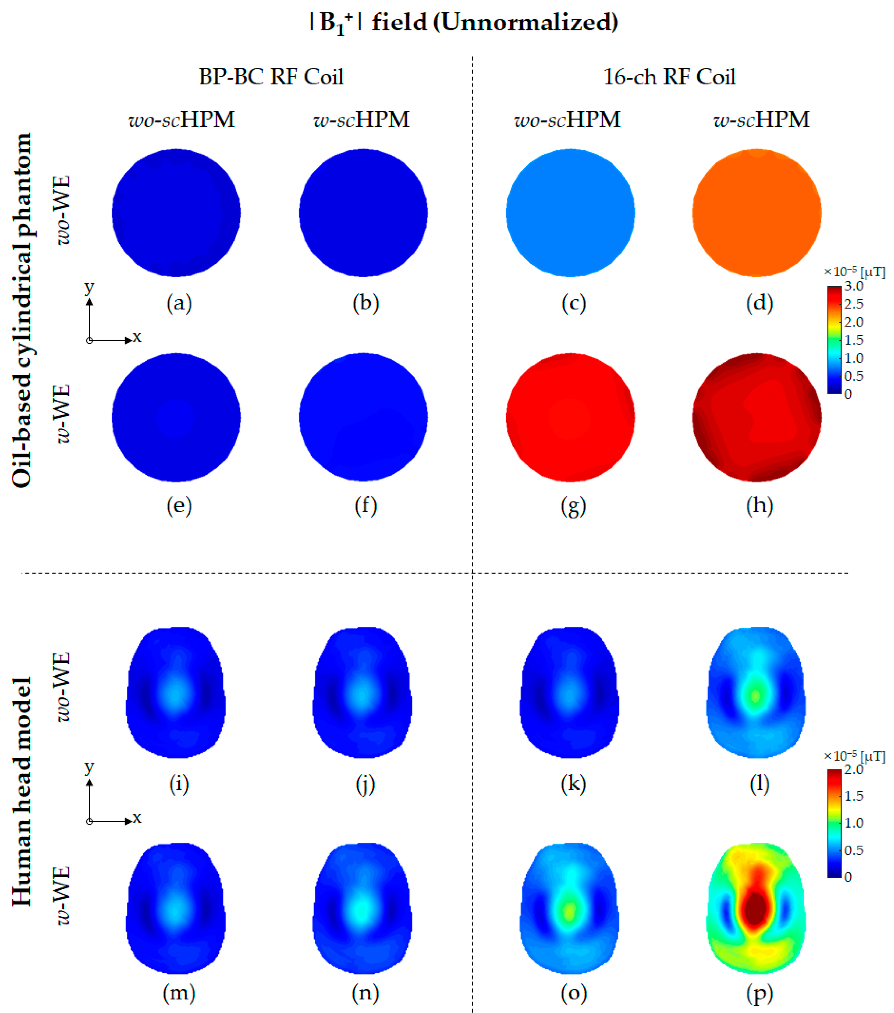 Sensors | Free Full-Text | A New Combination Of Radio-Frequency Coil ...