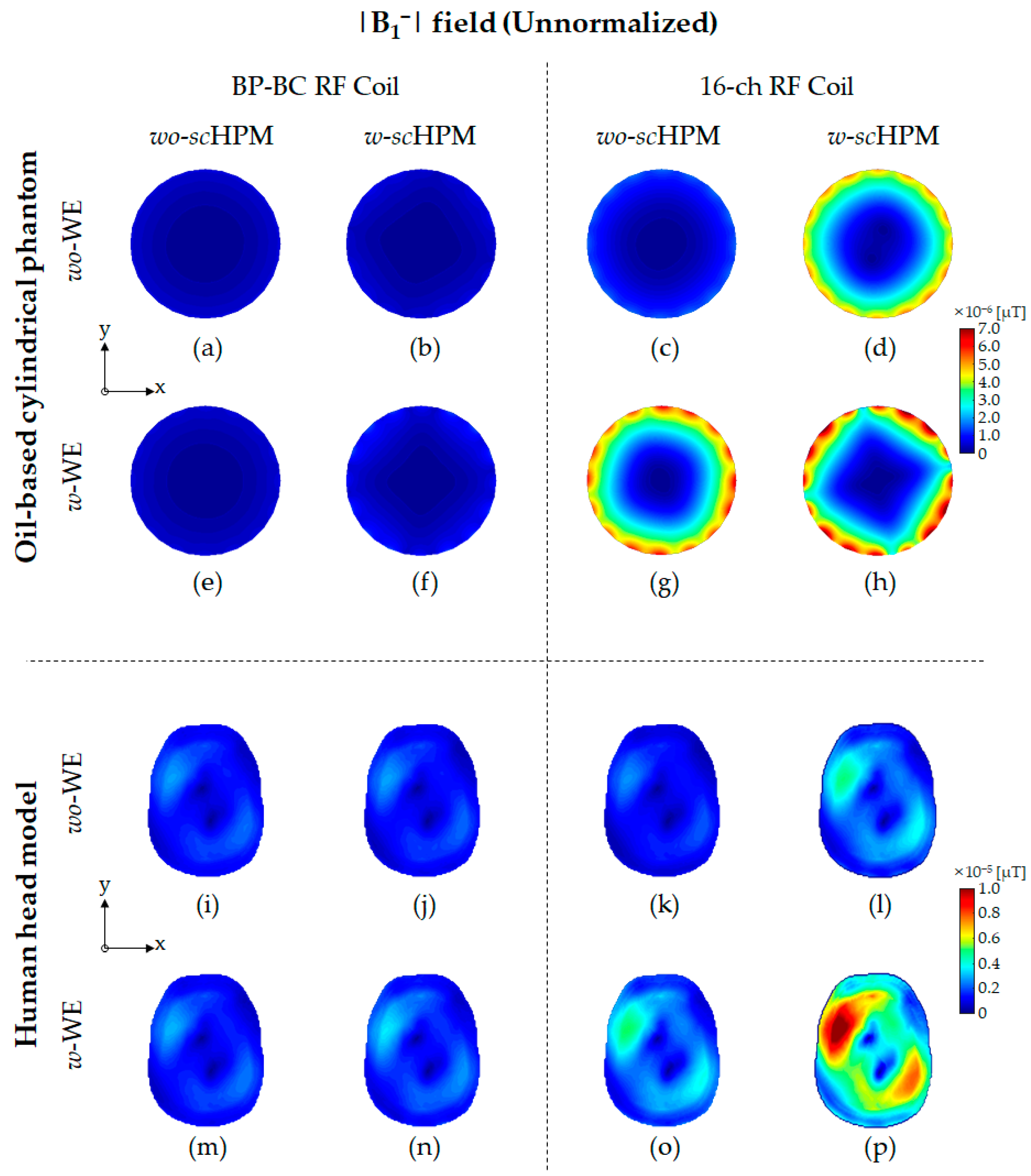 Sensors | Free Full-Text | A New Combination Of Radio-Frequency Coil ...