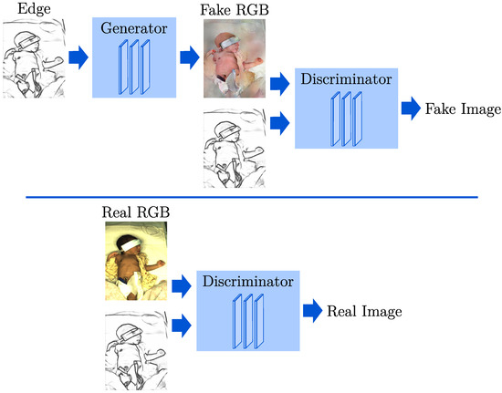 Sensors | Free Full-Text Conditional Generative Adversarial Networks Data Augmentation of a Neonatal Image Dataset